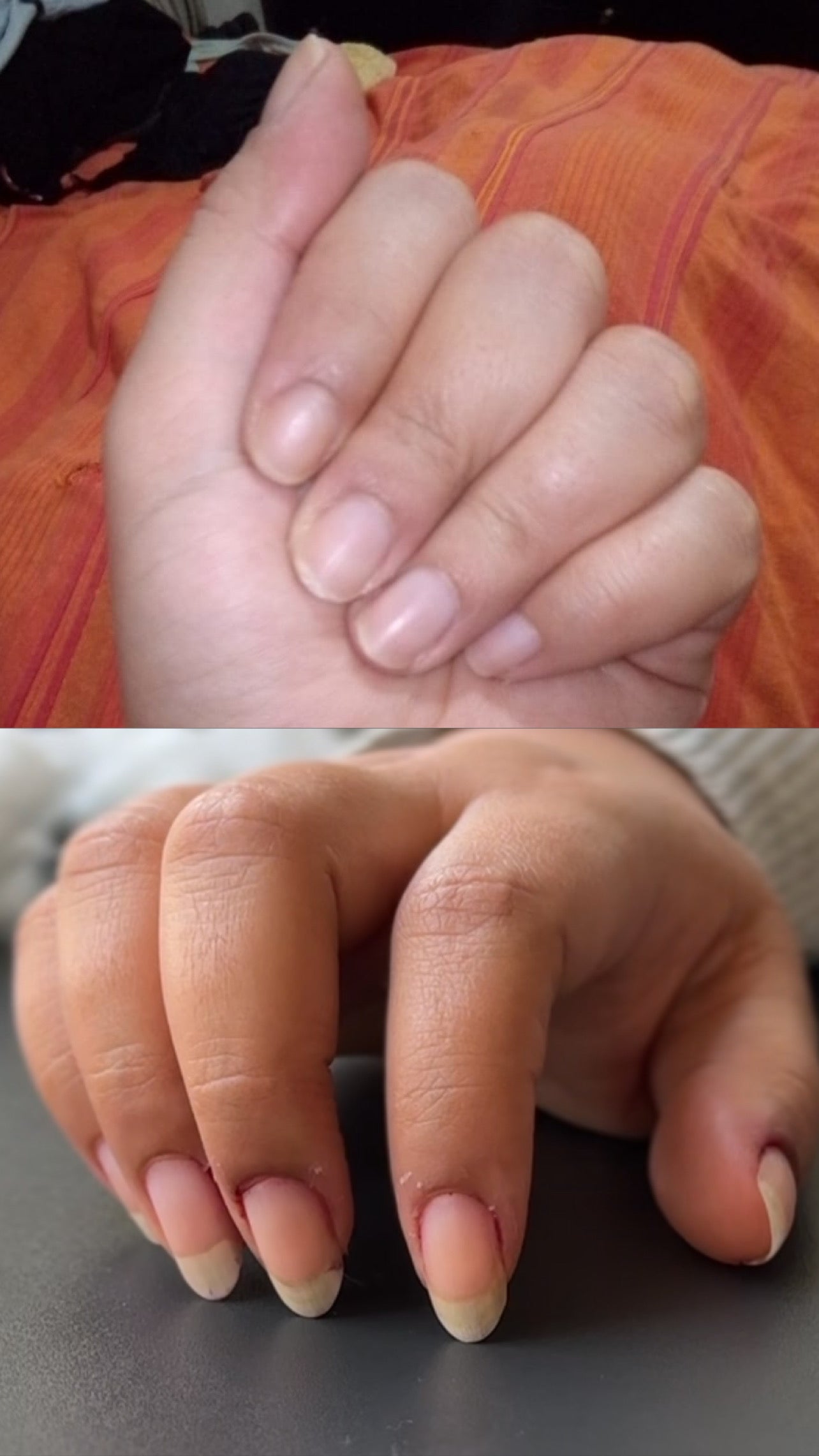 L’ANTIDOTE – Nail Regeneration Oil