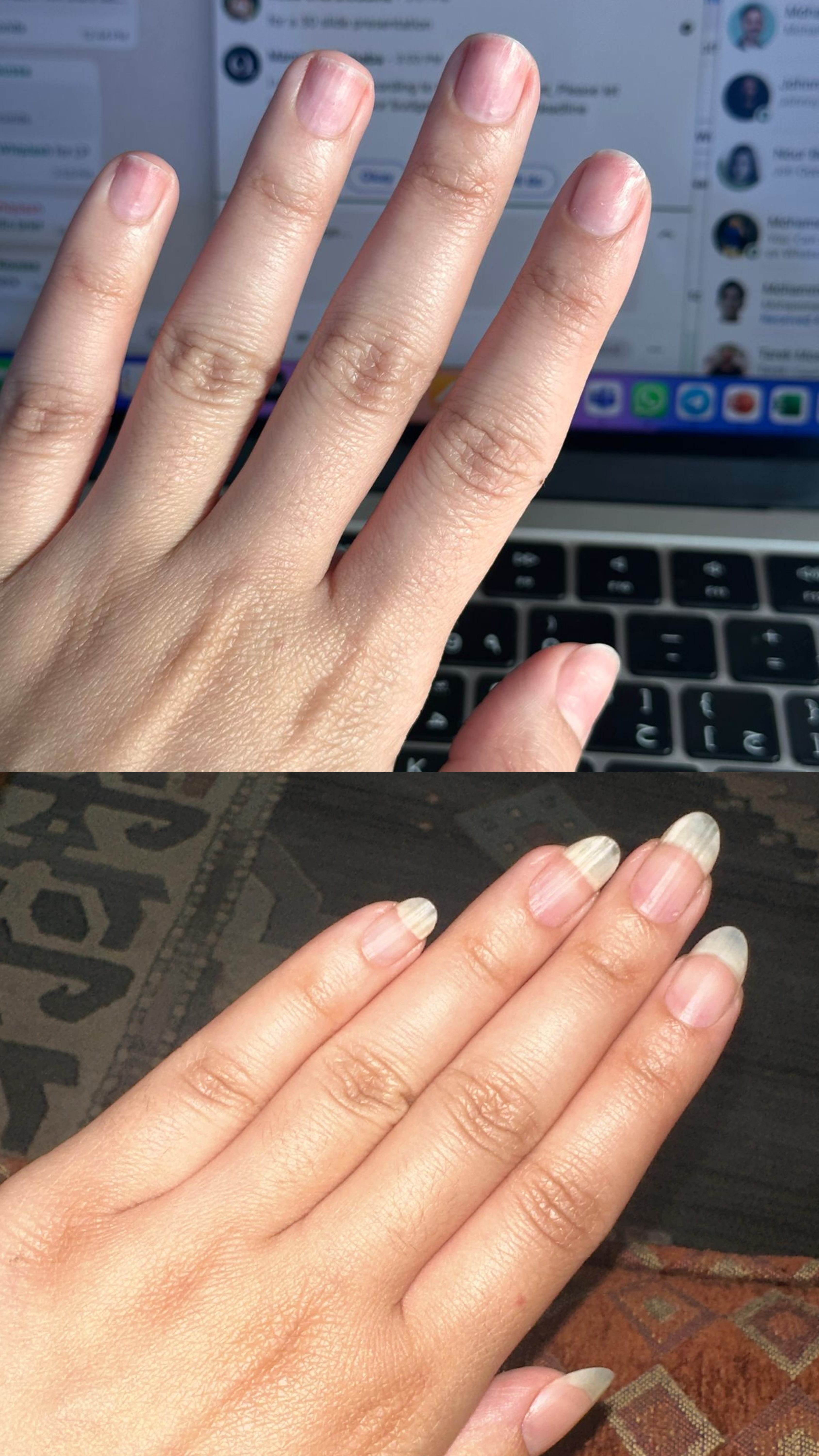 L’ANTIDOTE – Nail Regeneration Oil