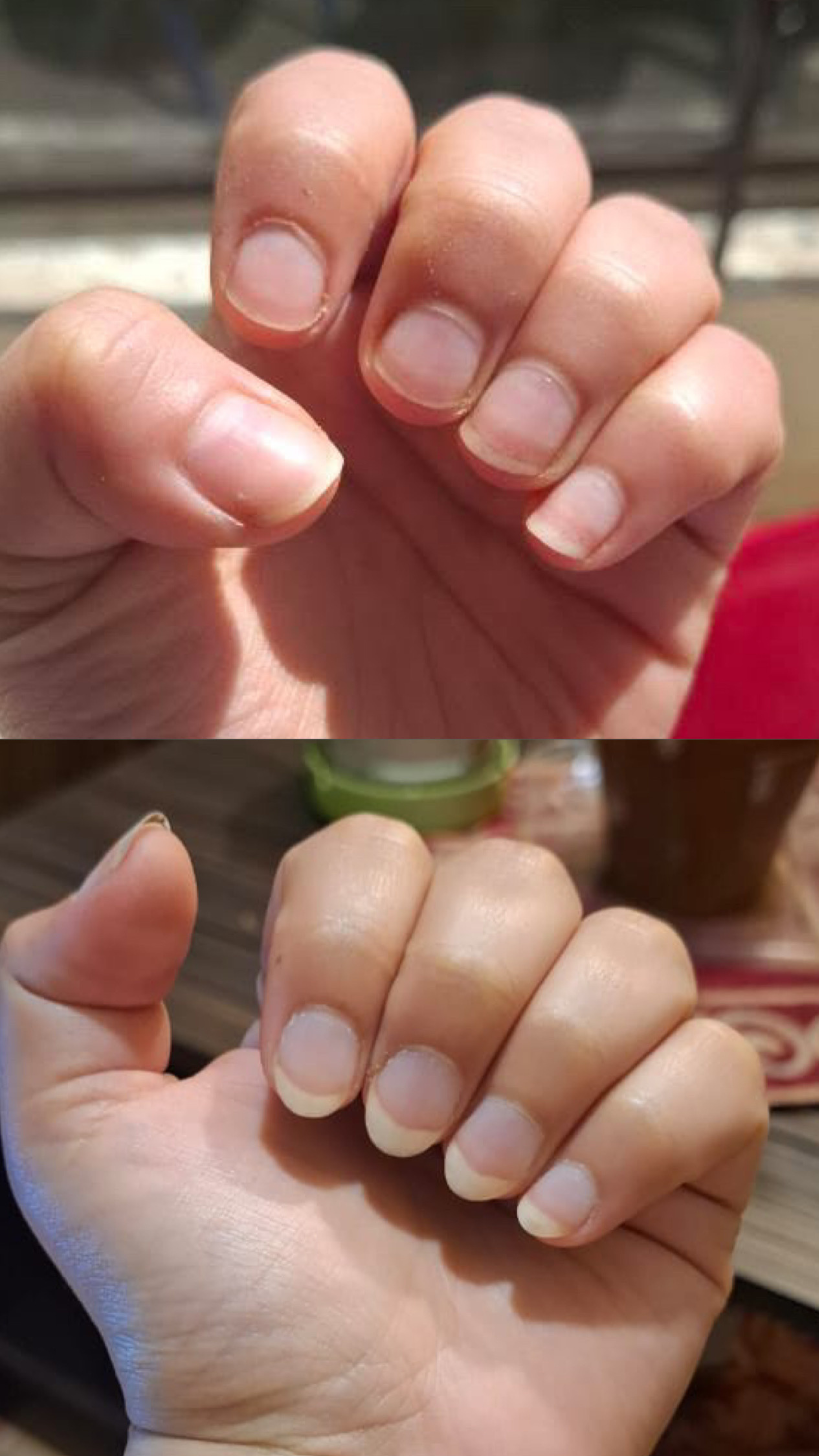 L’ANTIDOTE – Nail Regeneration Oil