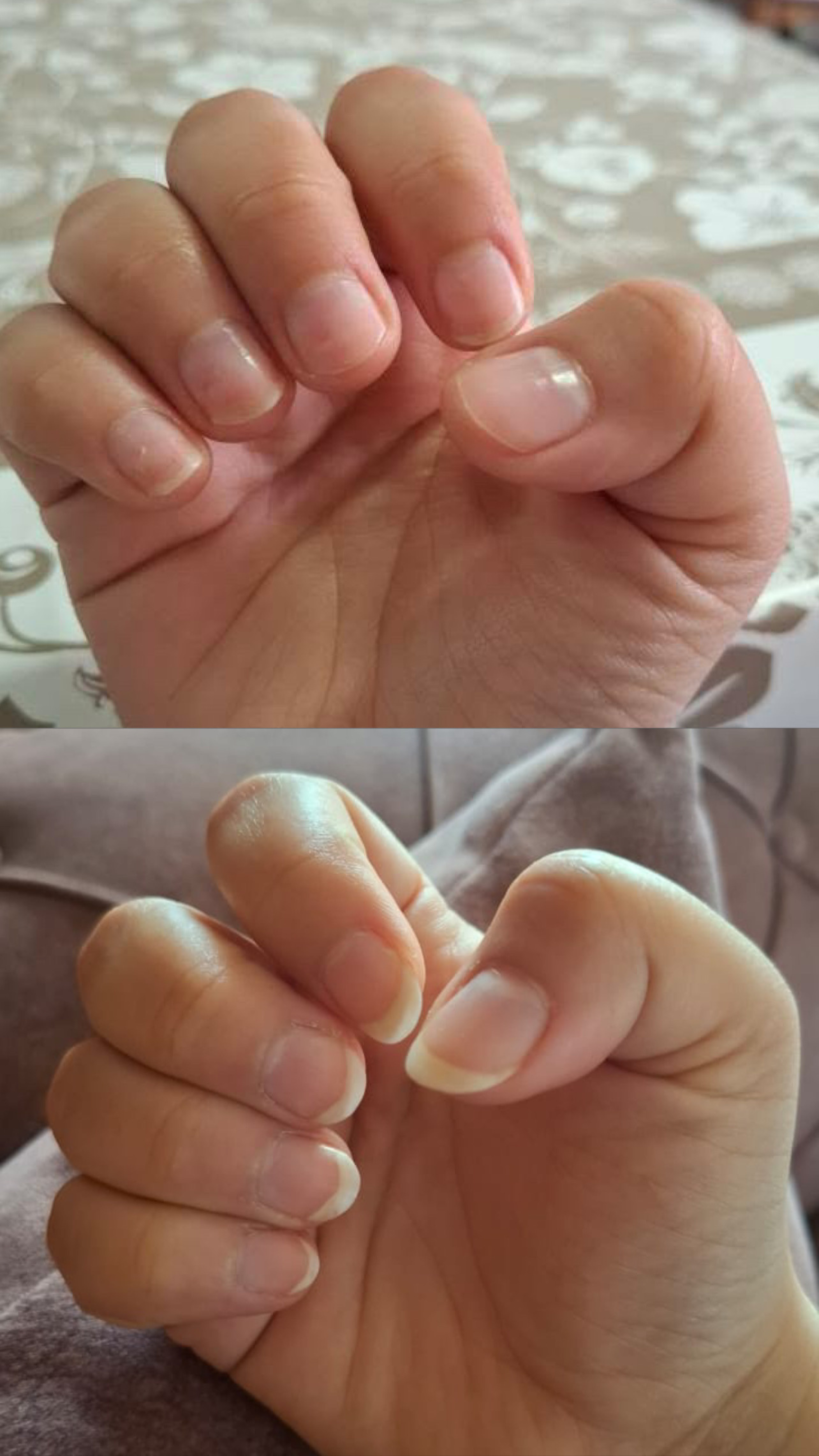 L’ANTIDOTE – Nail Regeneration Oil