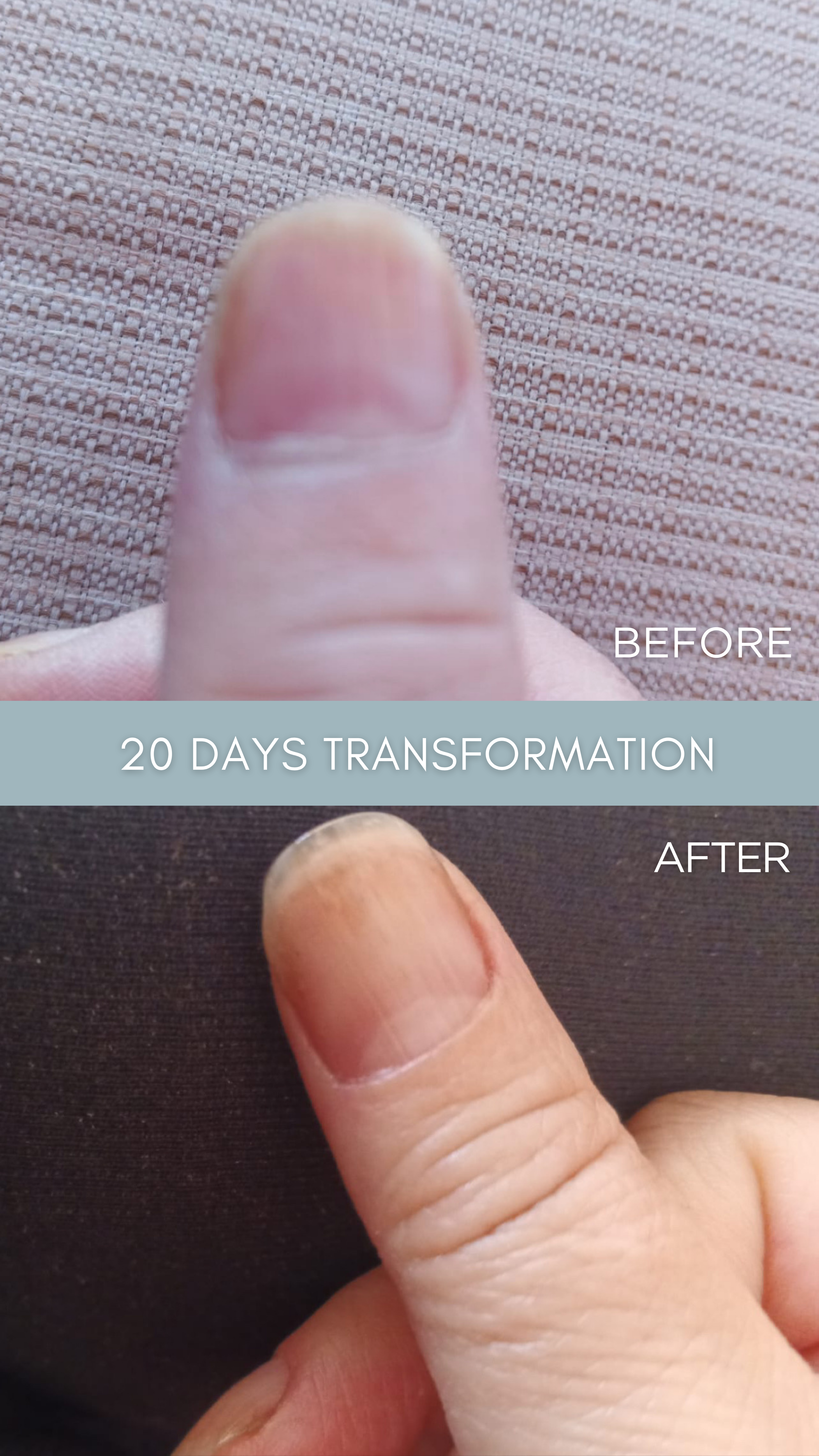 LE REMÈDE – The Antifungal Nail Restoration Oil