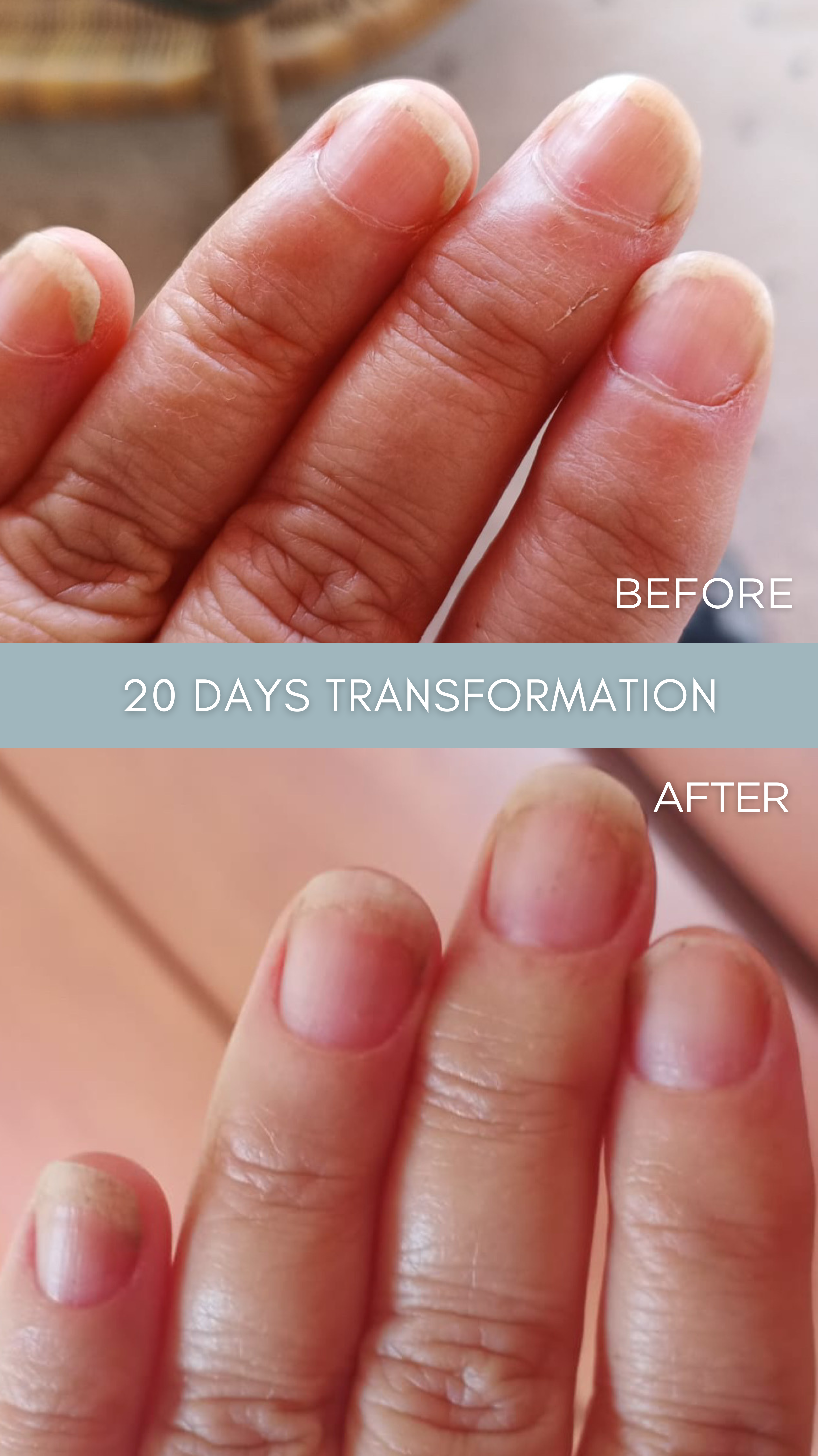 The Essential Fungus Healing Ritual