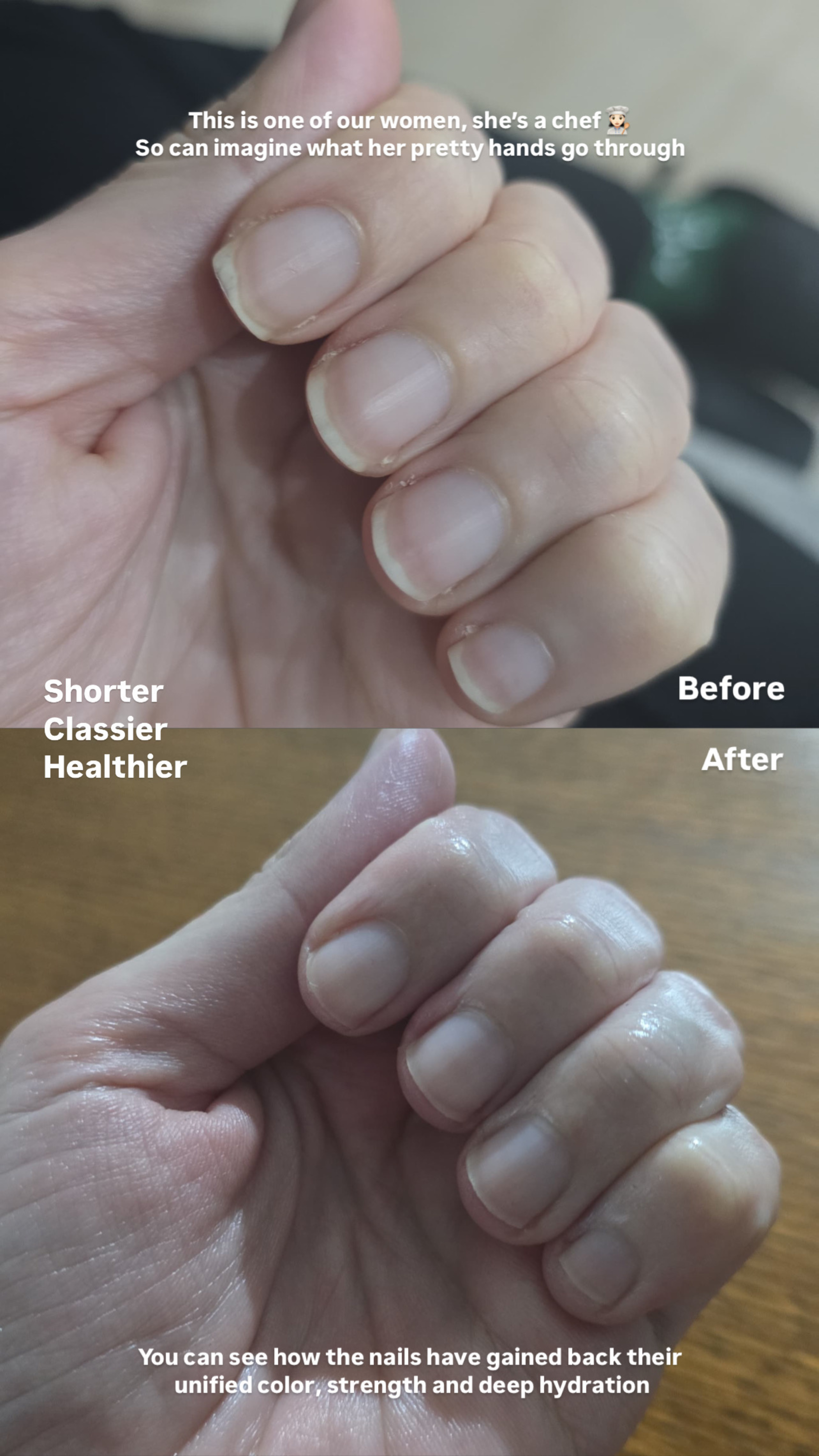 L’ANTIDOTE – Nail Regeneration Oil