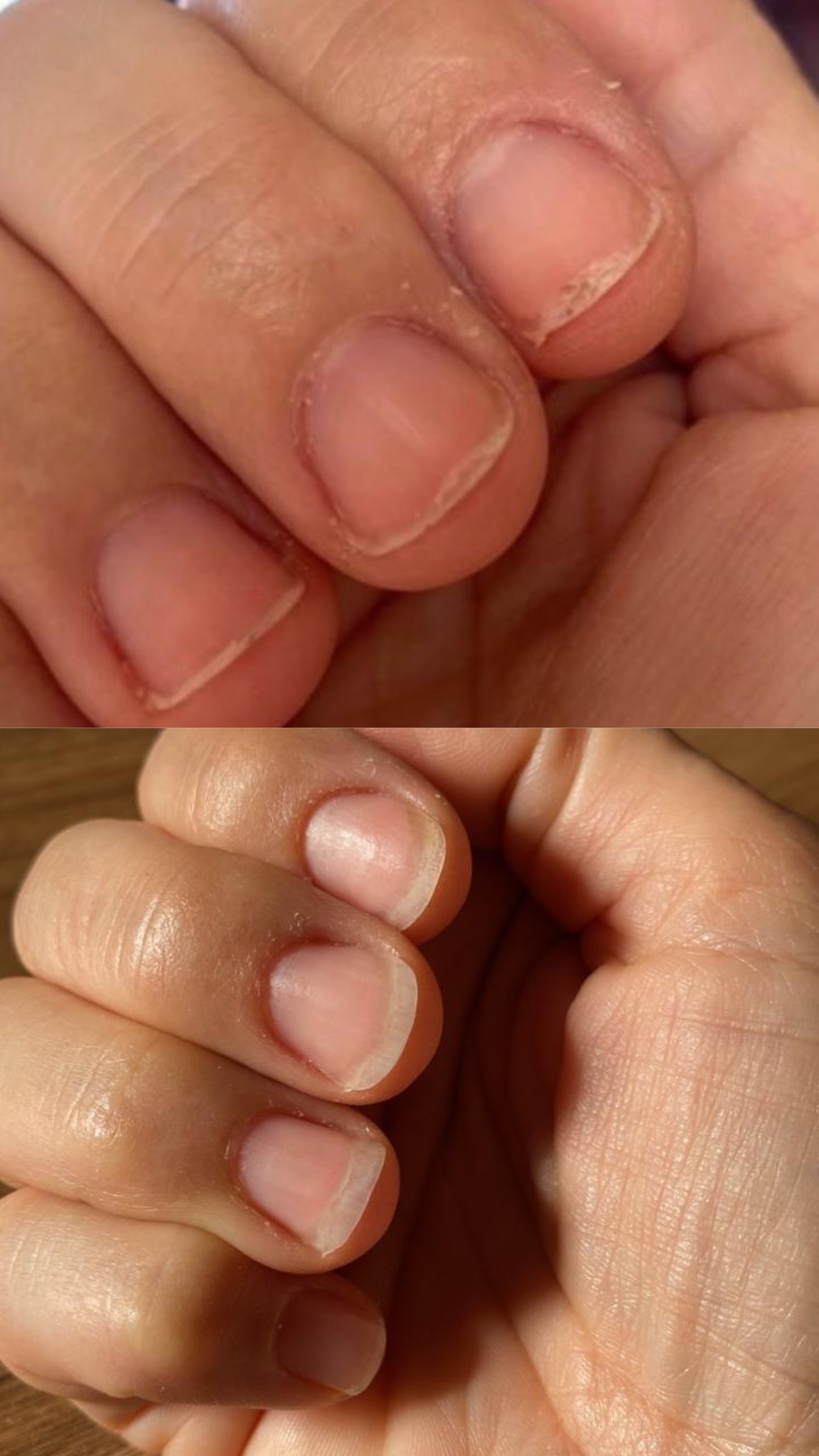 LUCIANA – The Miracle Nail Growth Oil