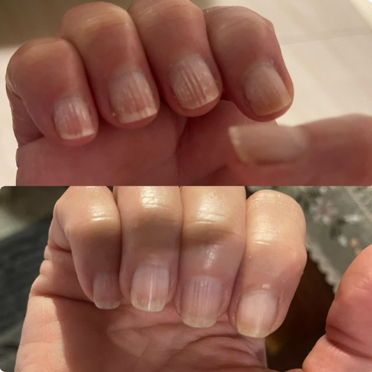 LE LISSEUR – Vertical Ridges Smoothing Oil
