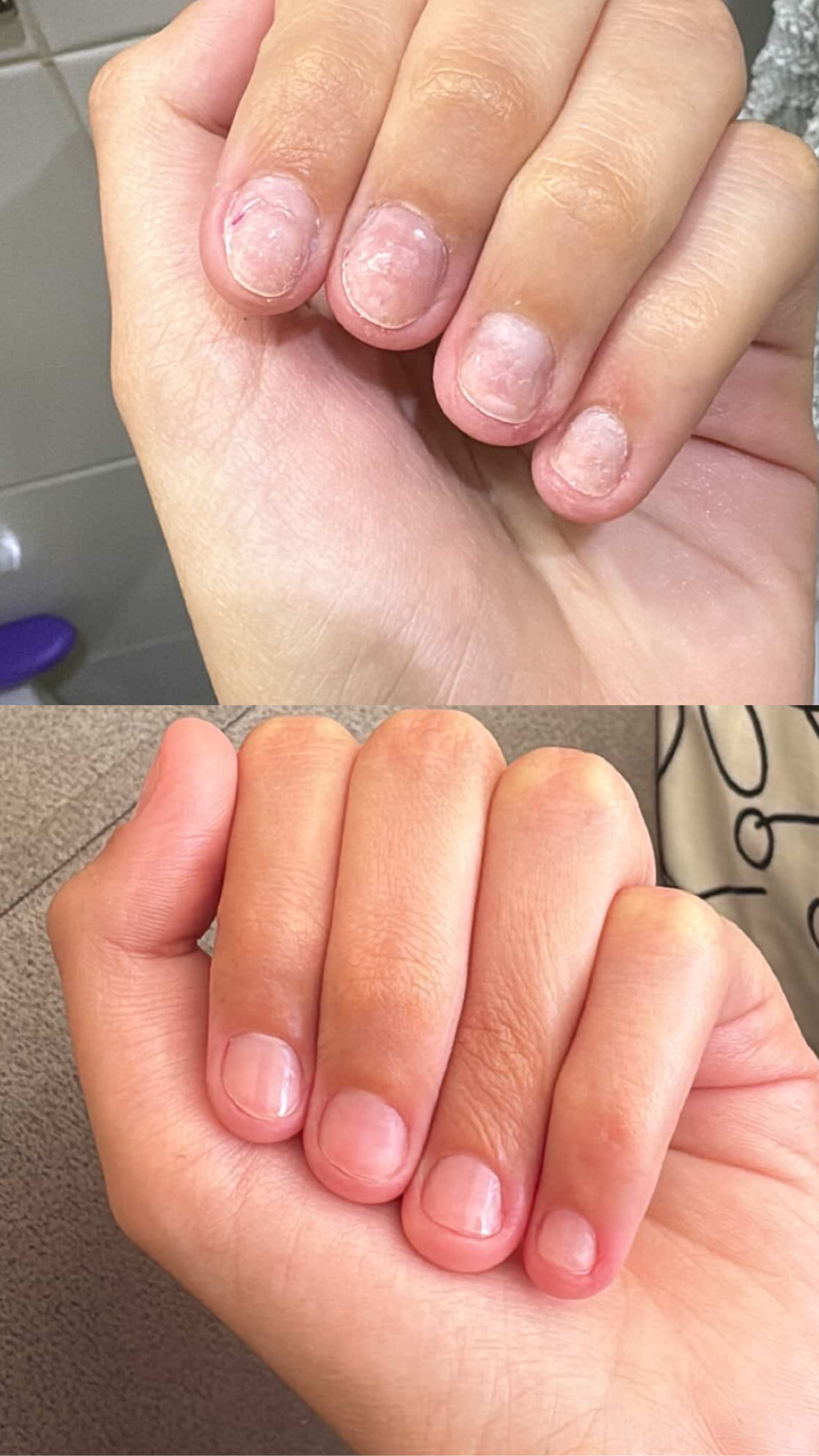 L’ANTIDOTE – Nail Regeneration Oil