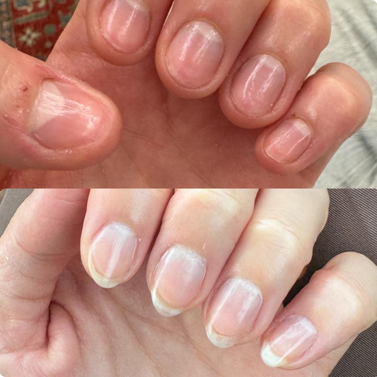 L’APAISANT – For Fragile, Flaky, and Ultra-Sensitive Nails