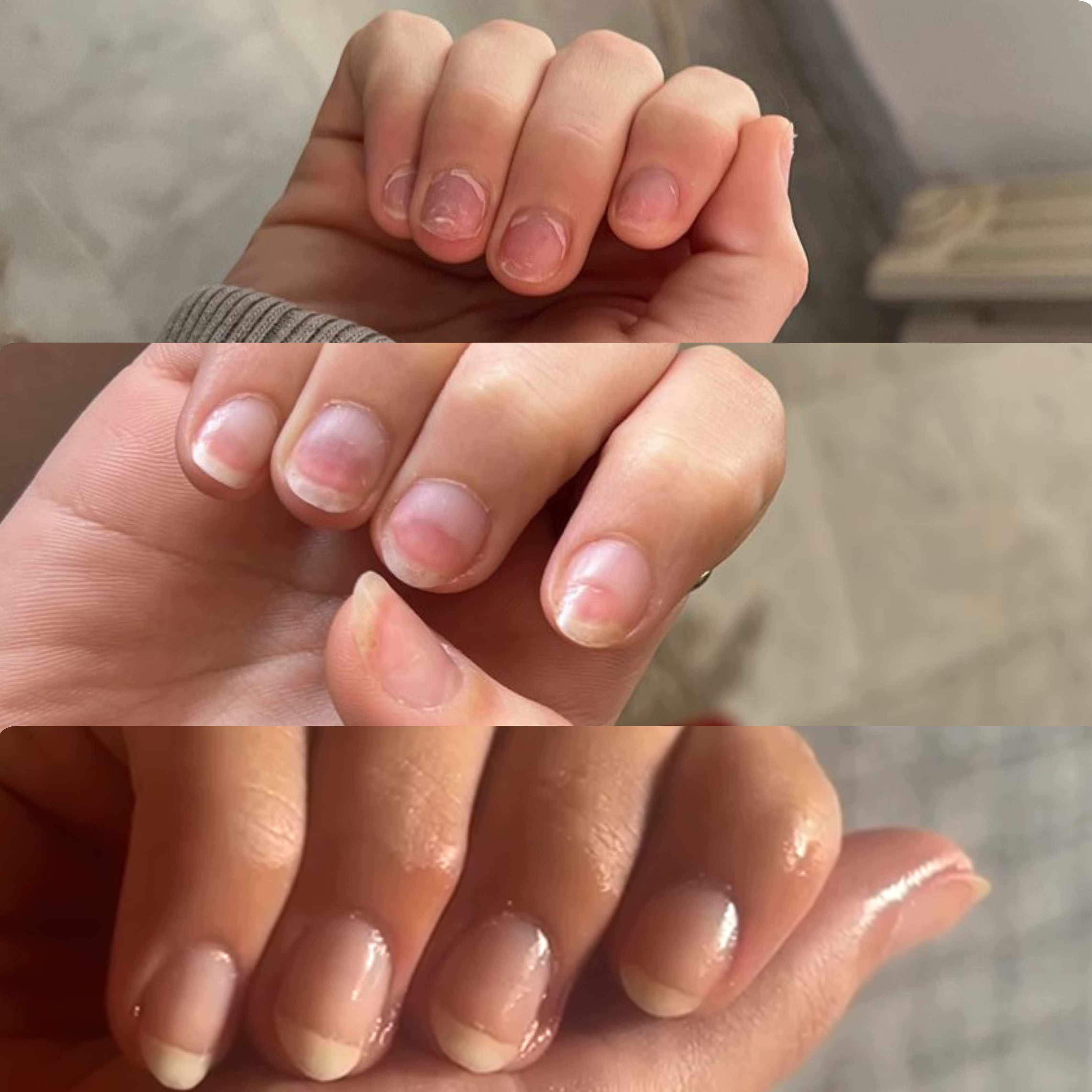 The Nail Ritual