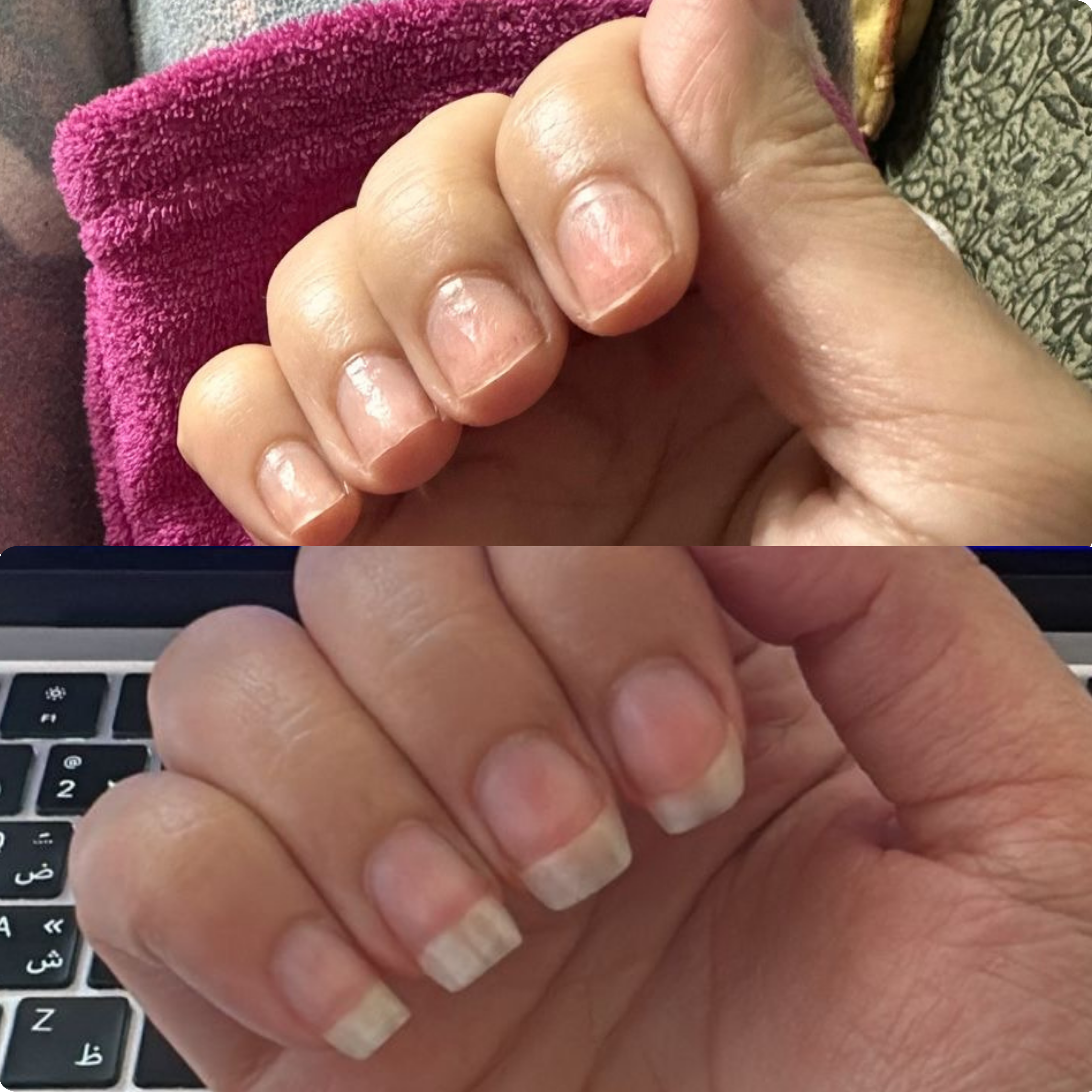 The Nail Ritual