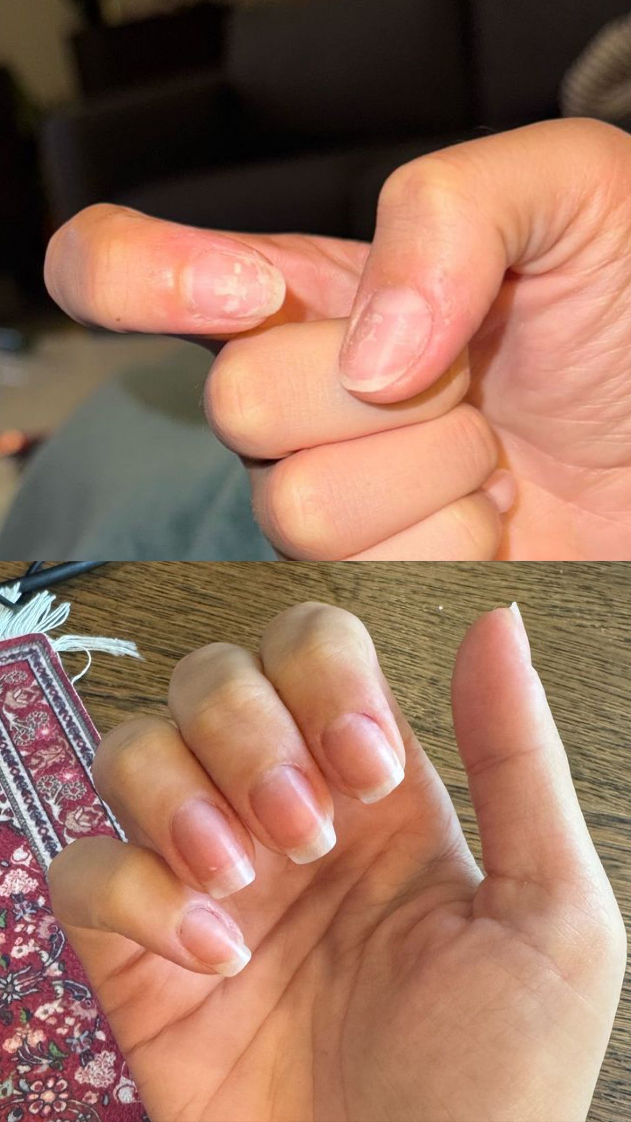 L’ANTIDOTE – Nail Regeneration Oil