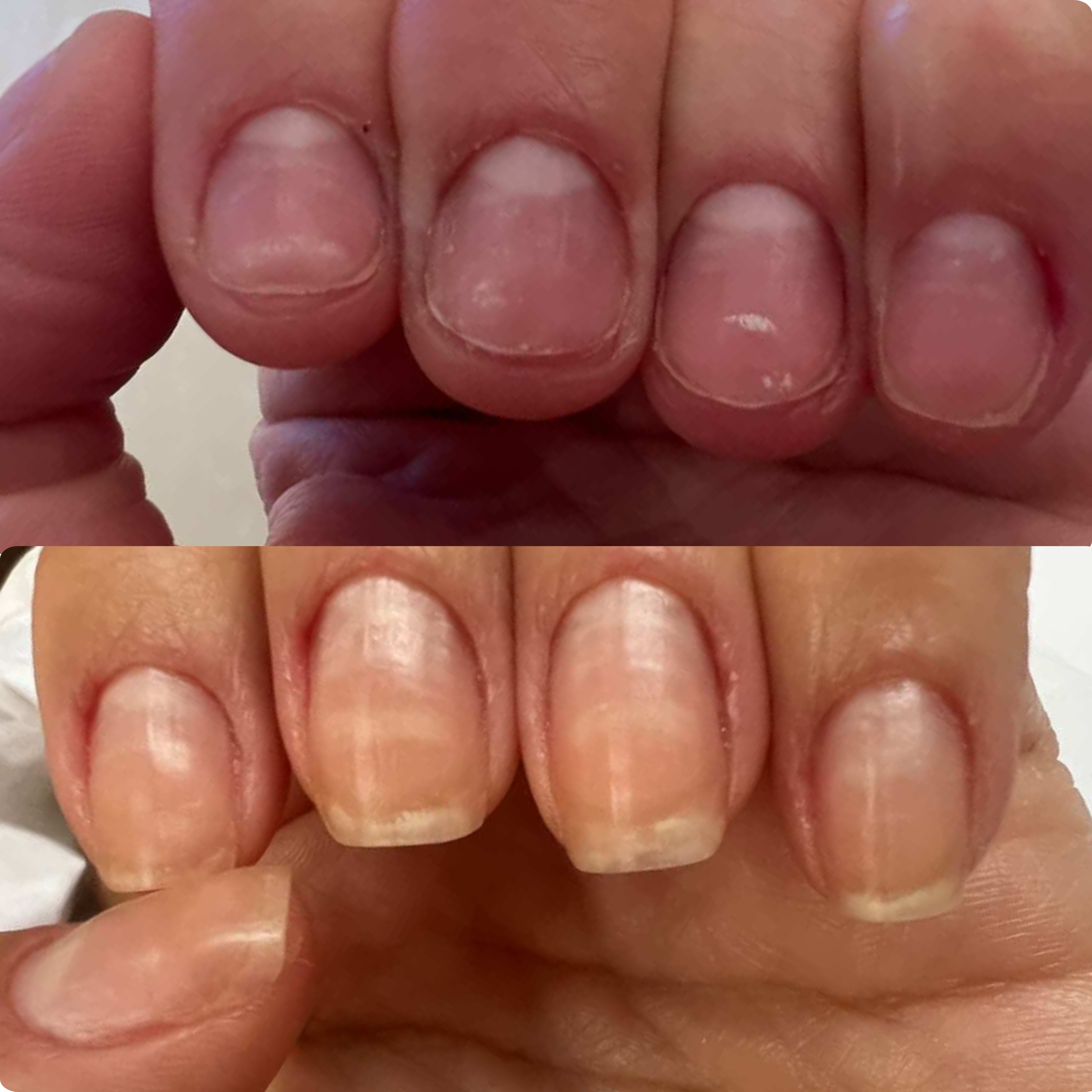 The 60-Day Nail Reset