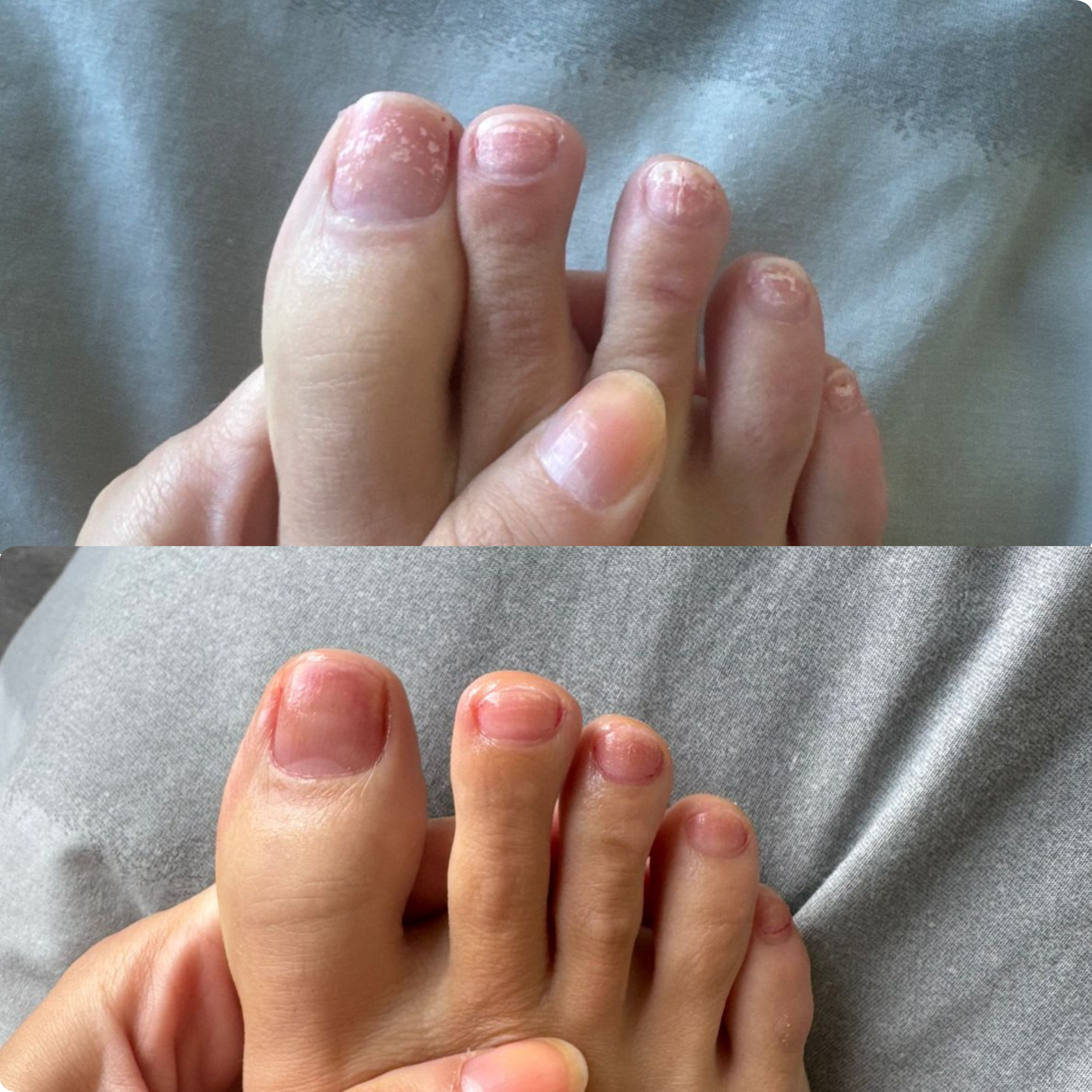 The Nail Ritual