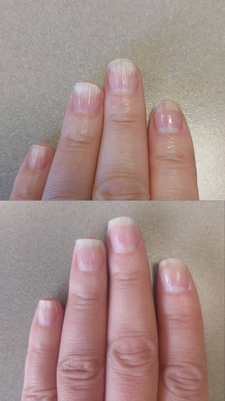 LE RÉVEIL – For Thickened, Textured, or Stubborn Nails