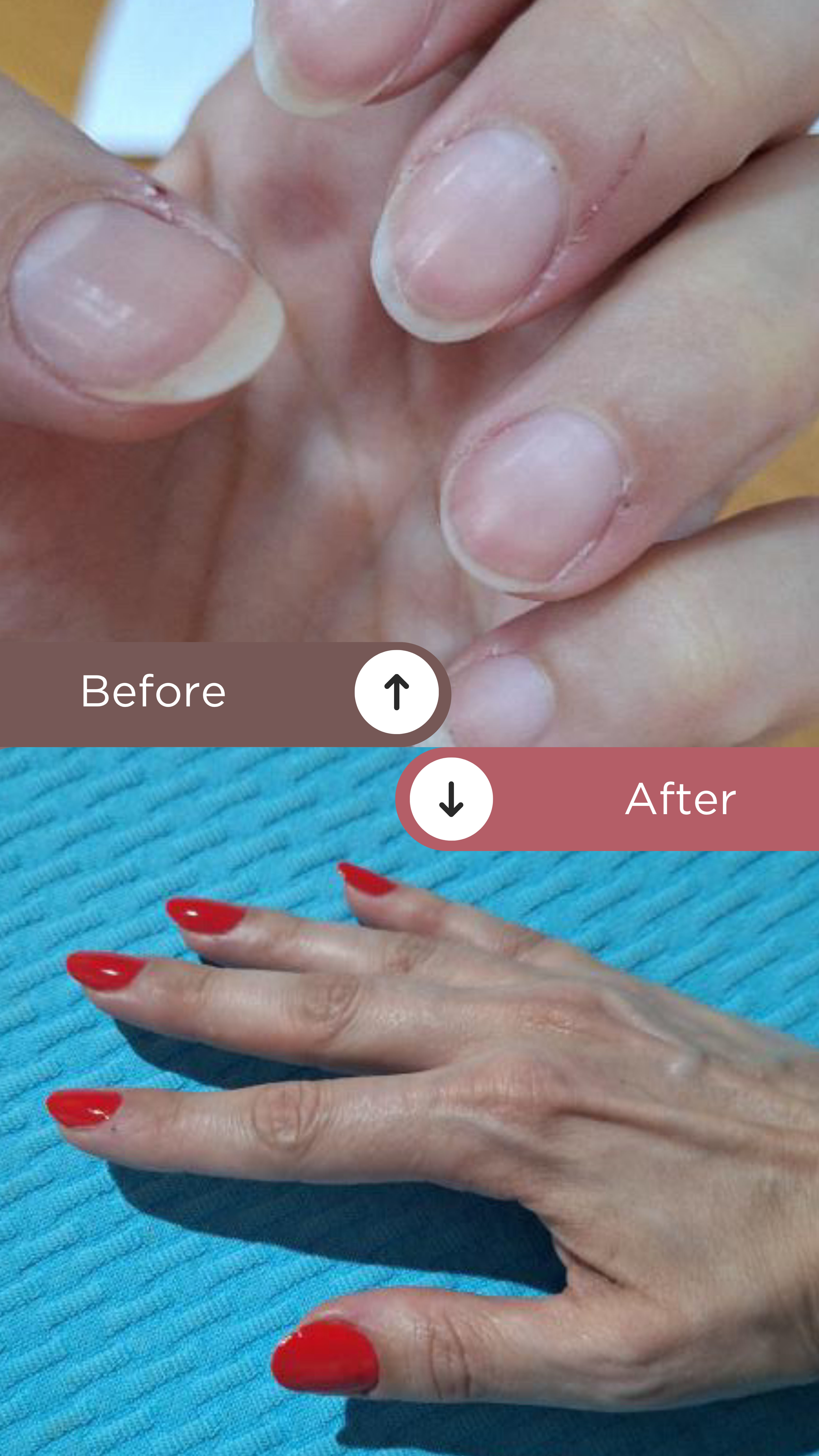 L’ANTIDOTE – Nail Regeneration Oil