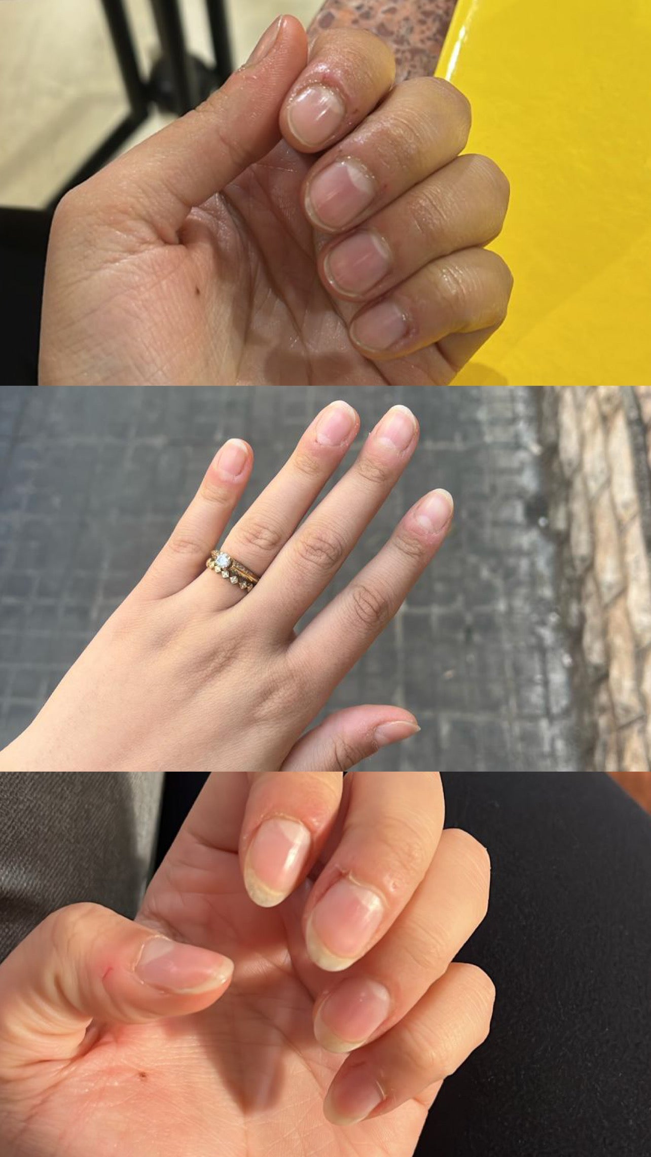 L’ANTIDOTE – Nail Regeneration Oil