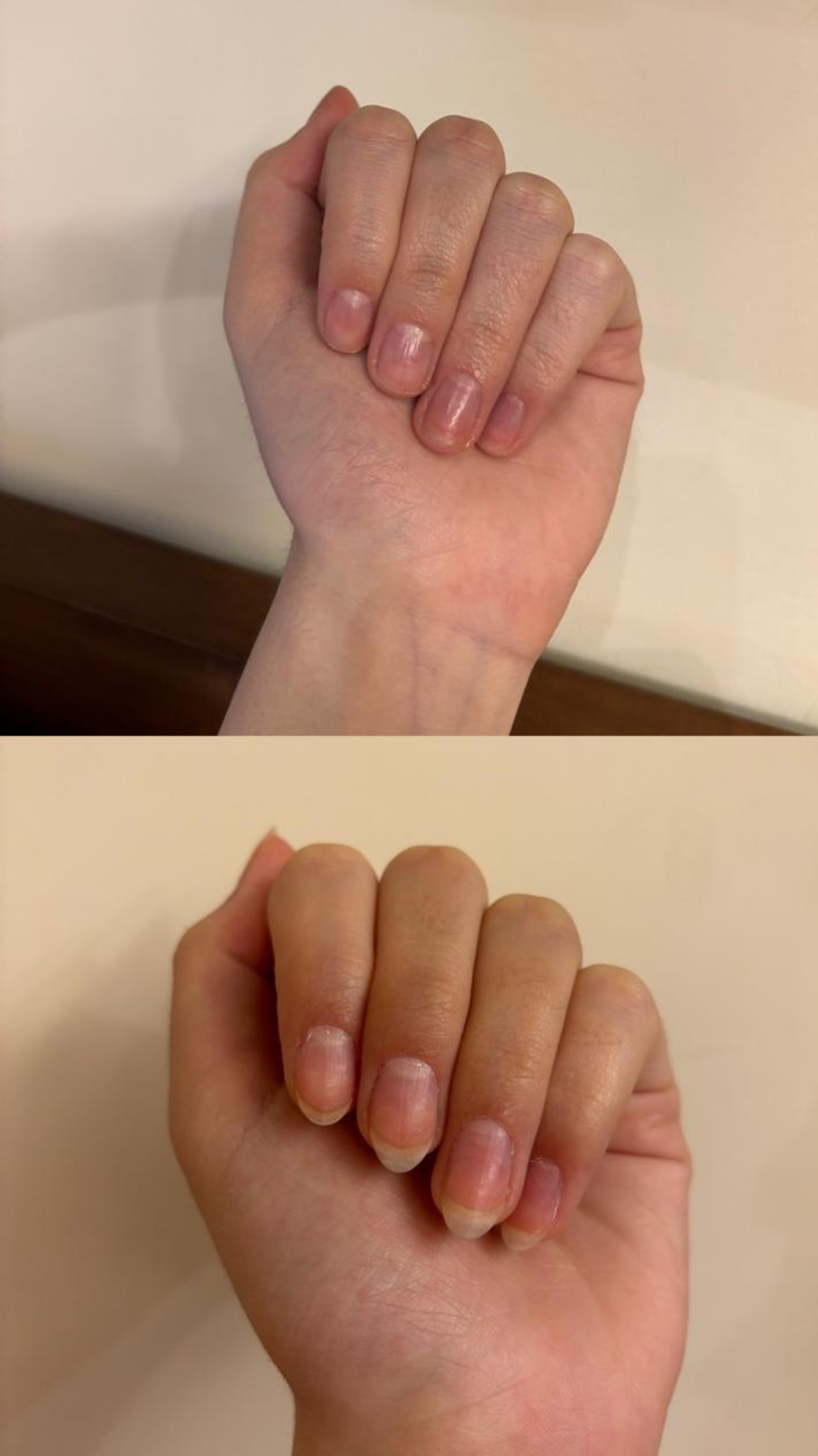 L’ANTIDOTE – Nail Regeneration Oil