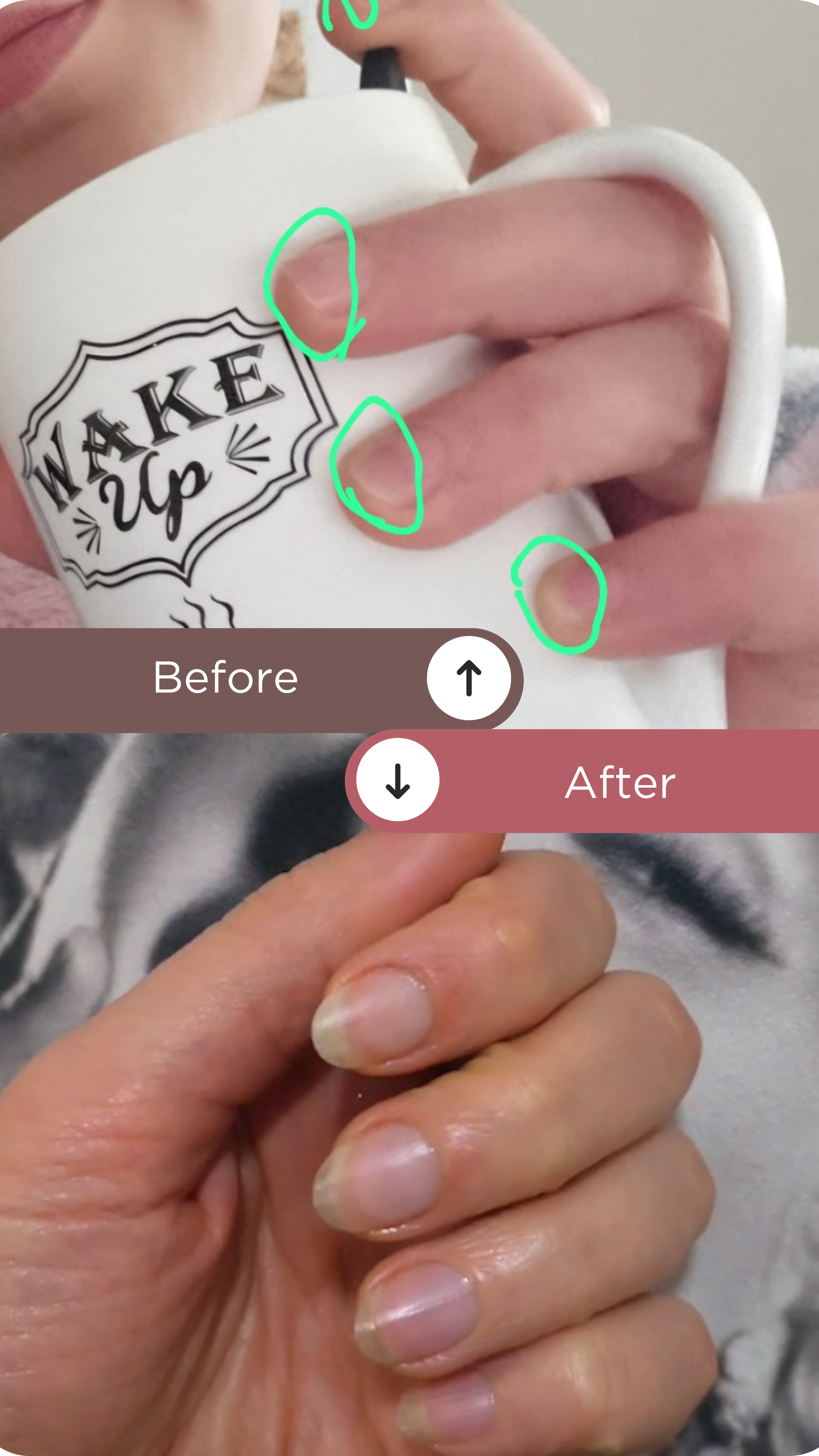 L’ANTIDOTE – Nail Regeneration Oil