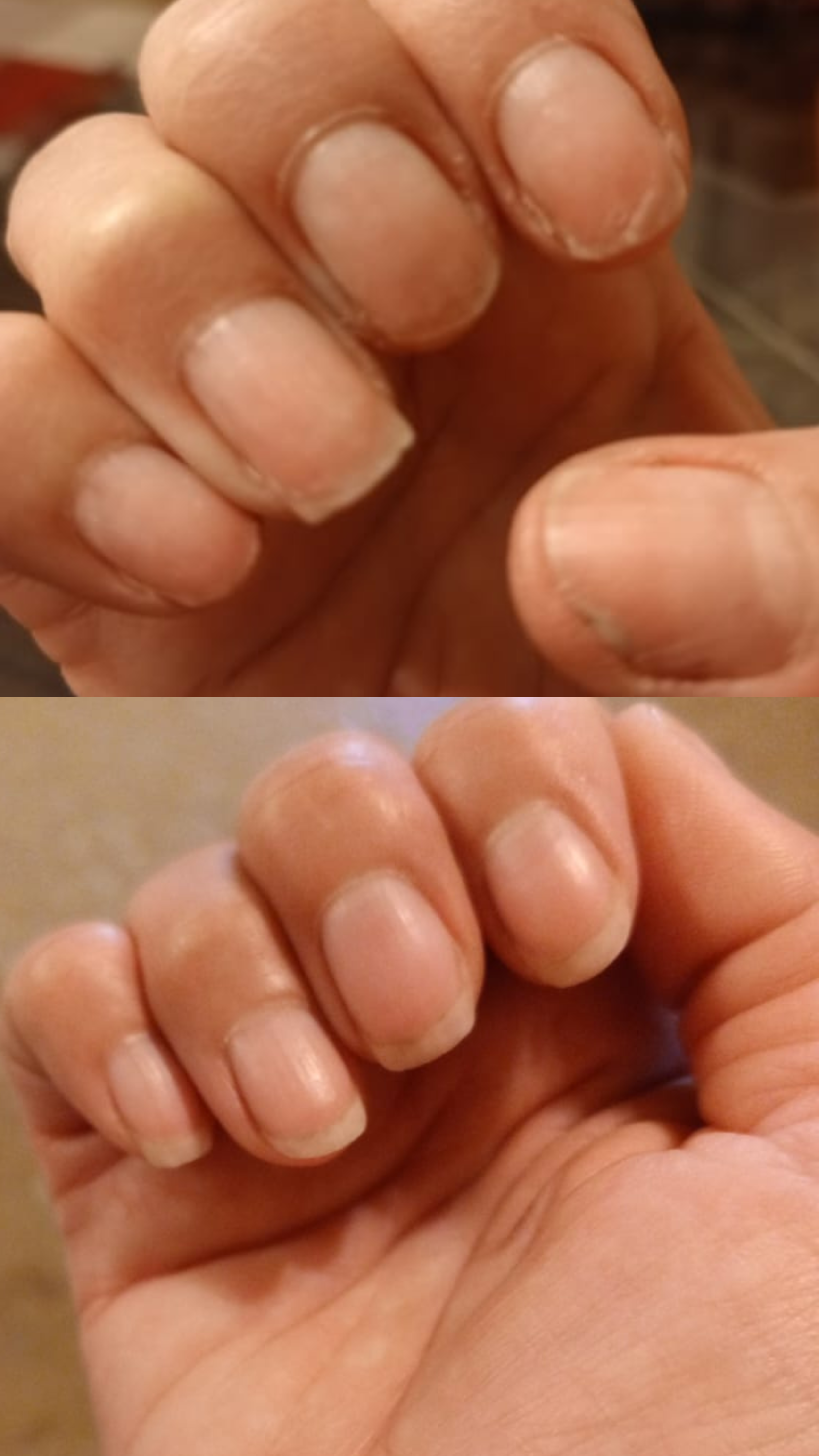 L’ANTIDOTE – Nail Regeneration Oil