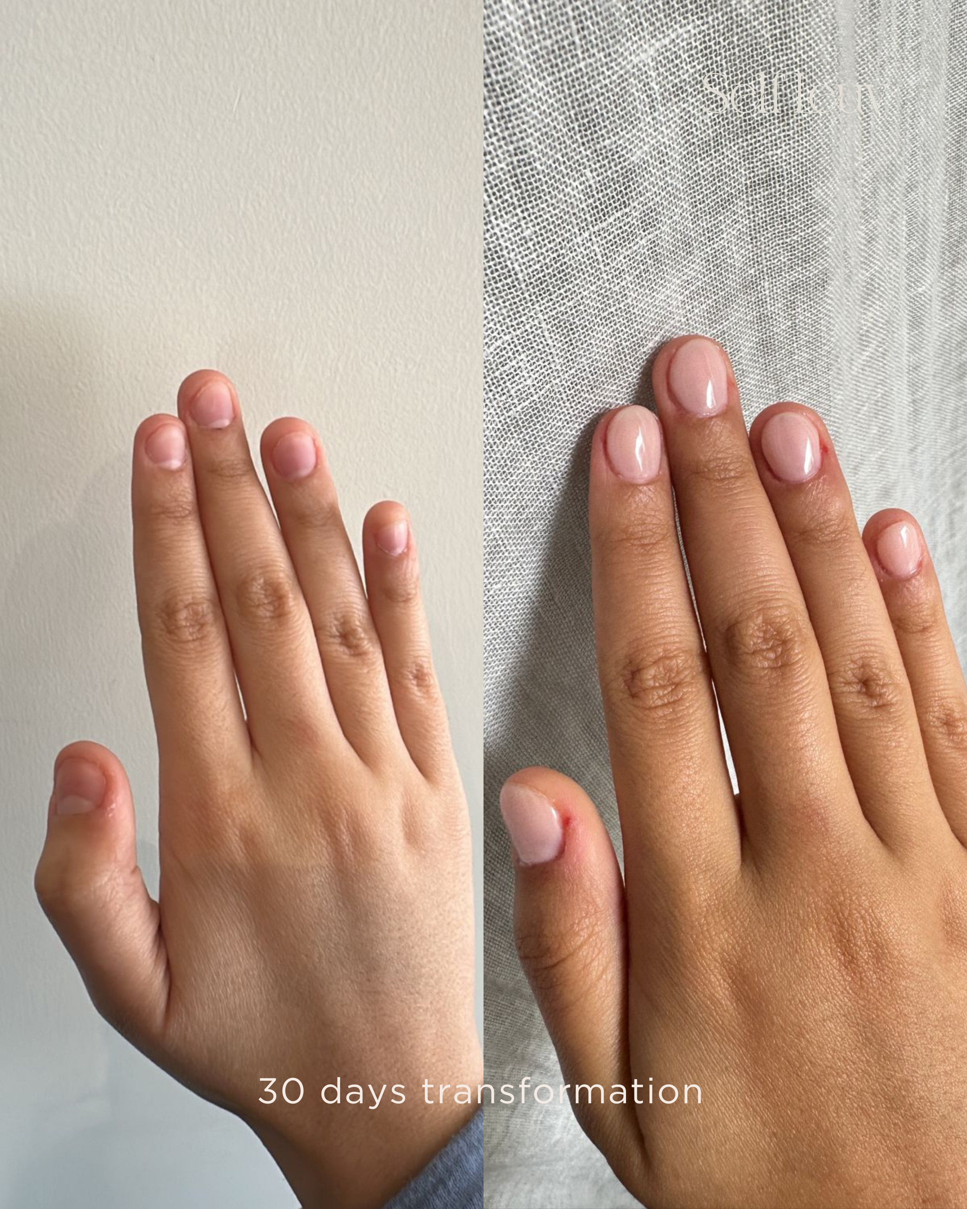 The Essential Nail Biting Ritual