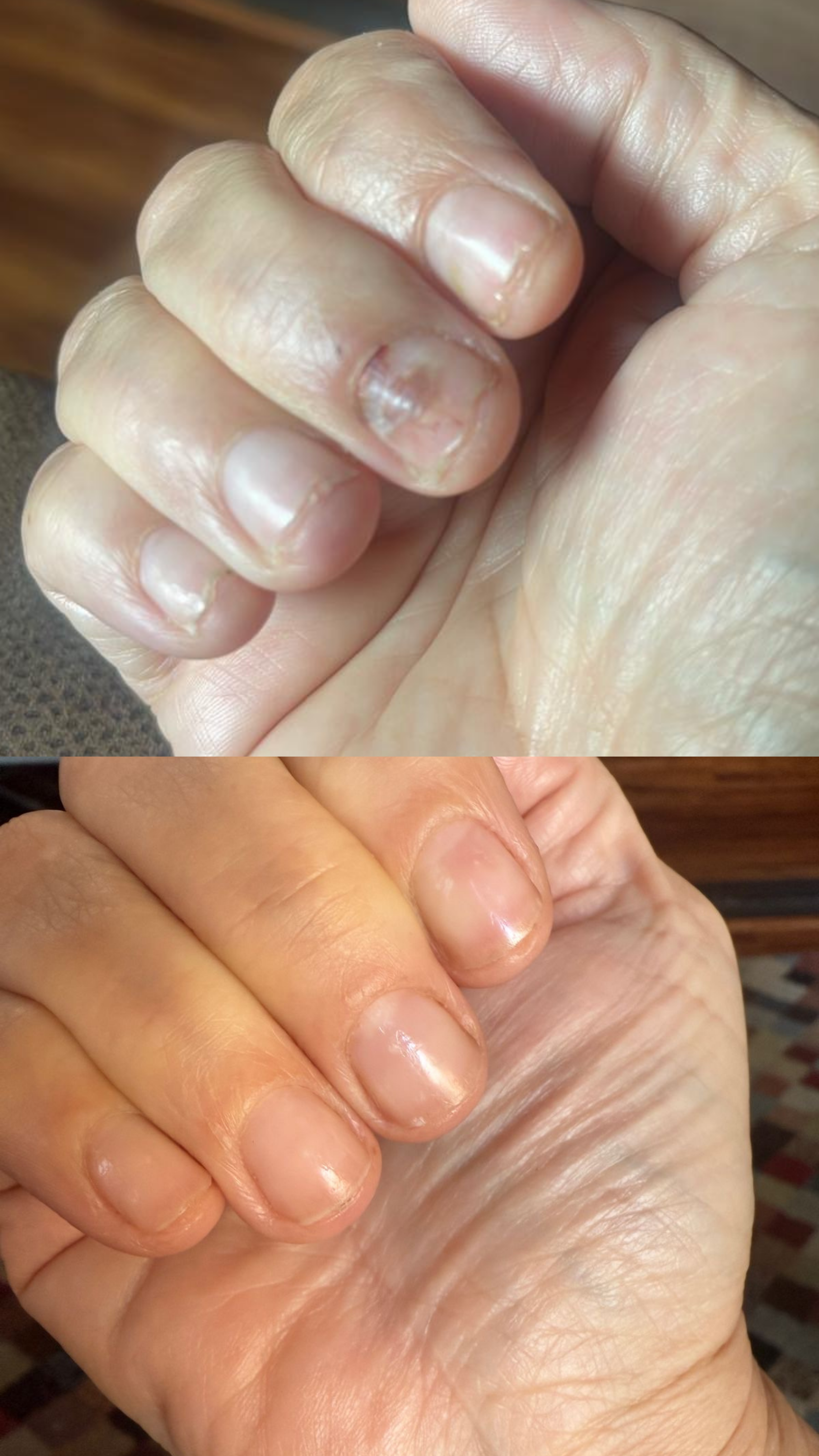 L’ANTIDOTE – Nail Regeneration Oil