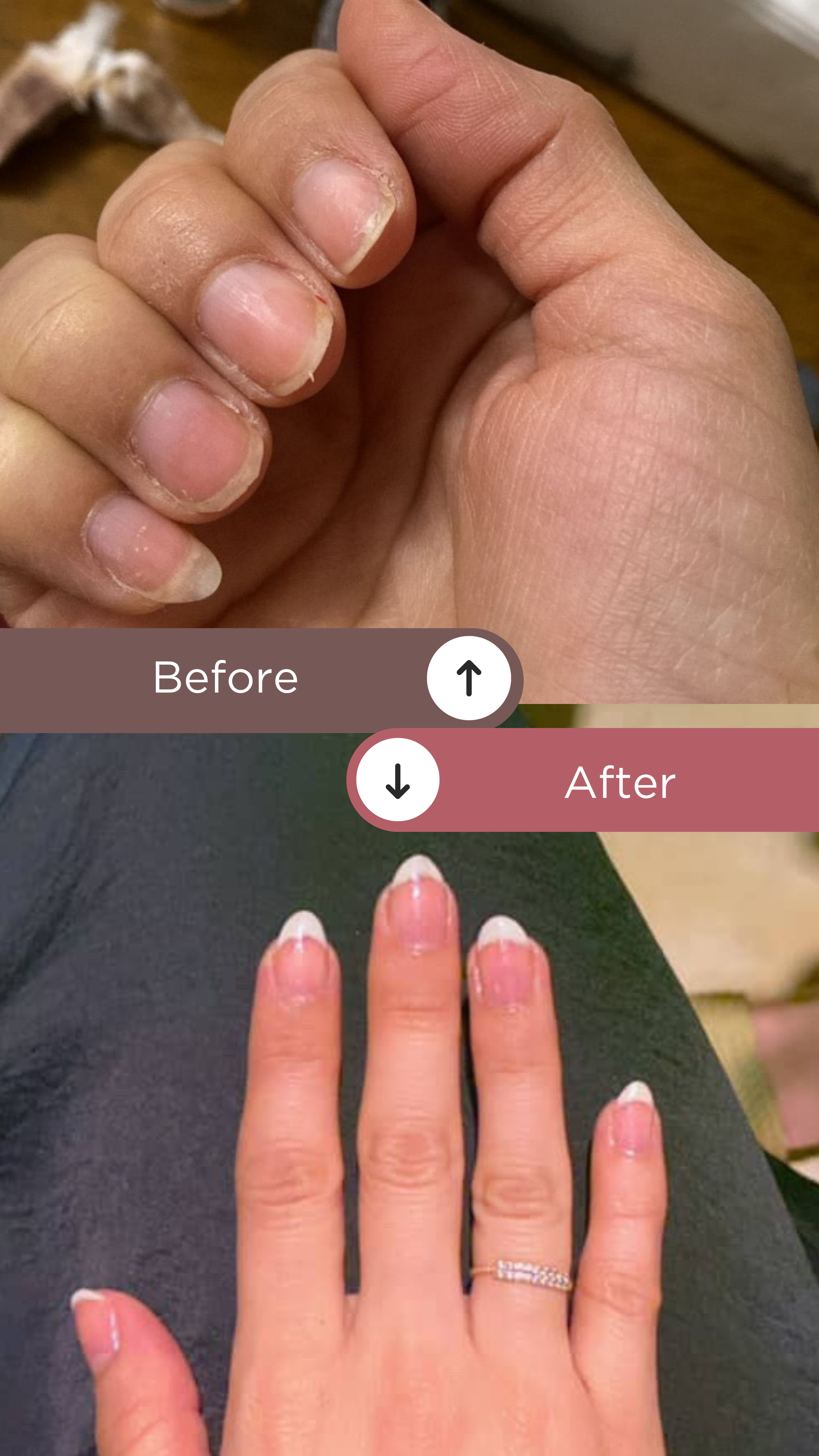 L’ANTIDOTE – Nail Regeneration Oil