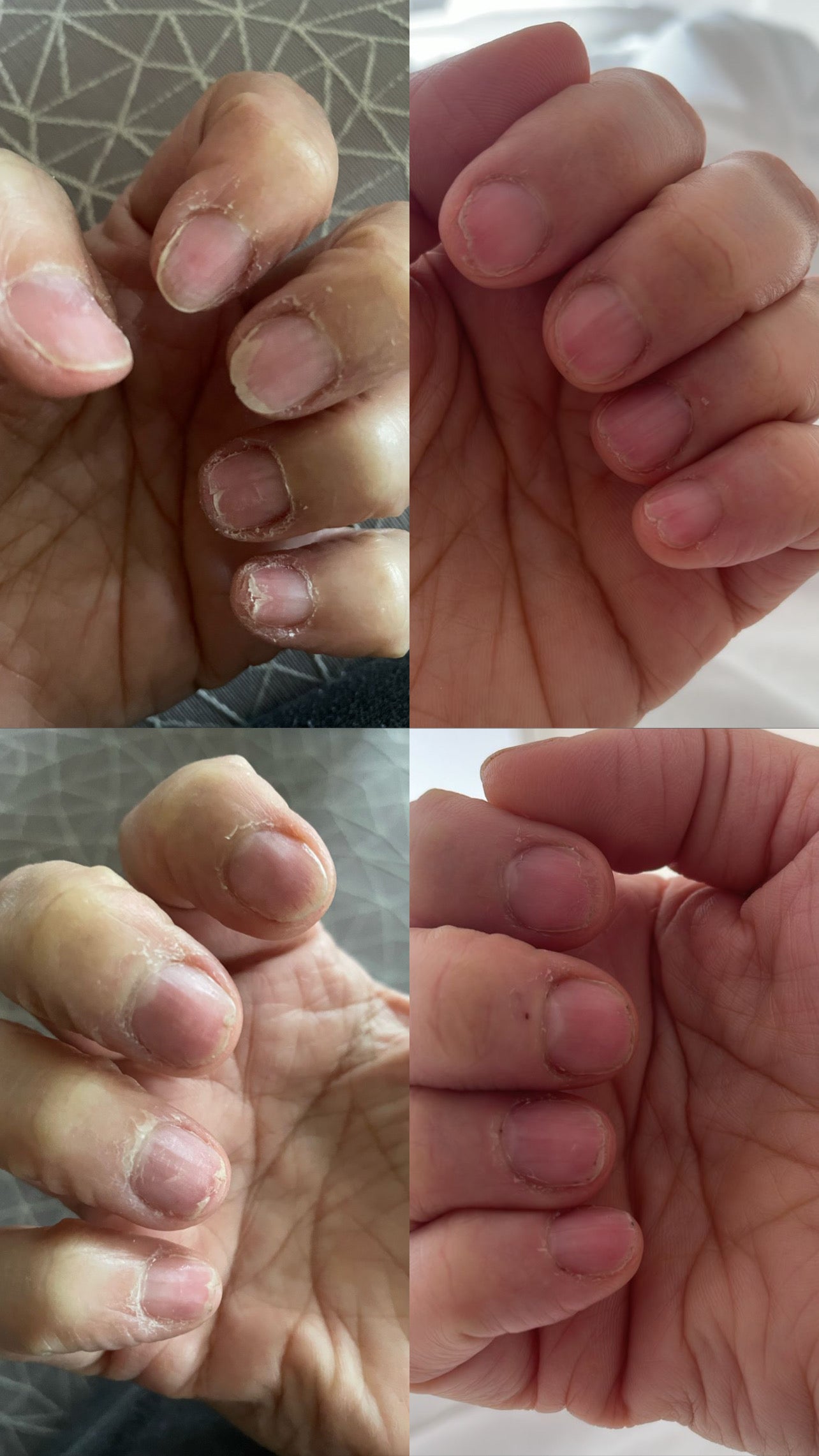 LE FORTIFIANT – Restorative Nail Oil for Sensitive Recovery