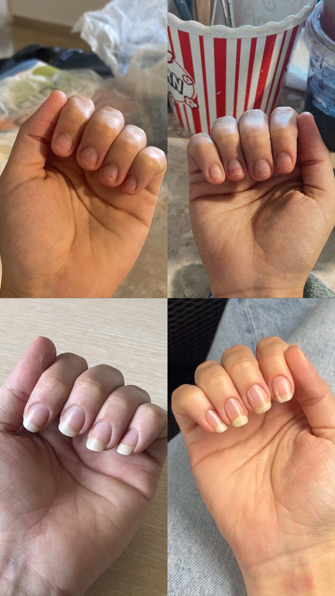 L’ANTIDOTE – Nail Regeneration Oil