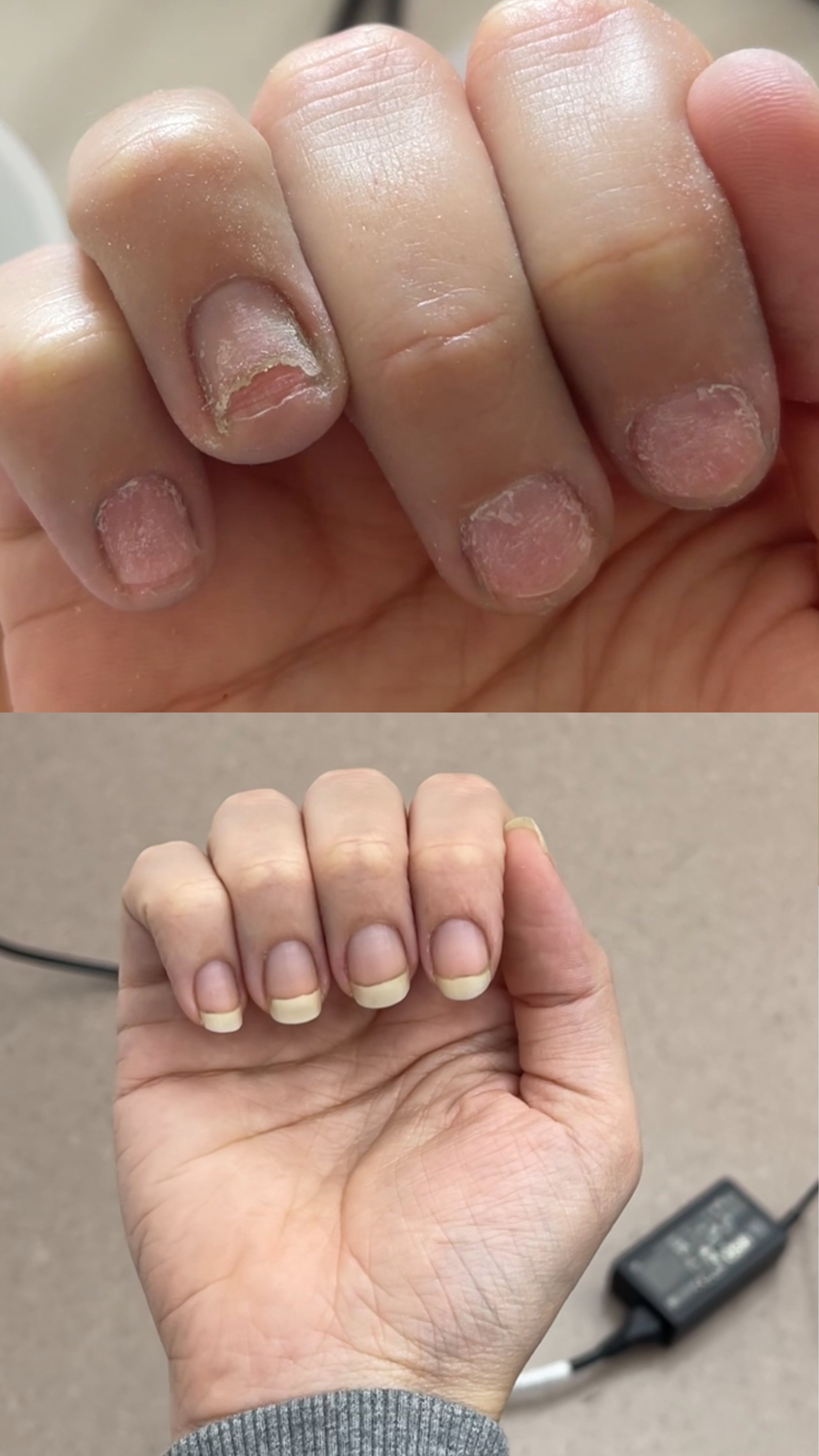 L’ANTIDOTE – Nail Regeneration Oil