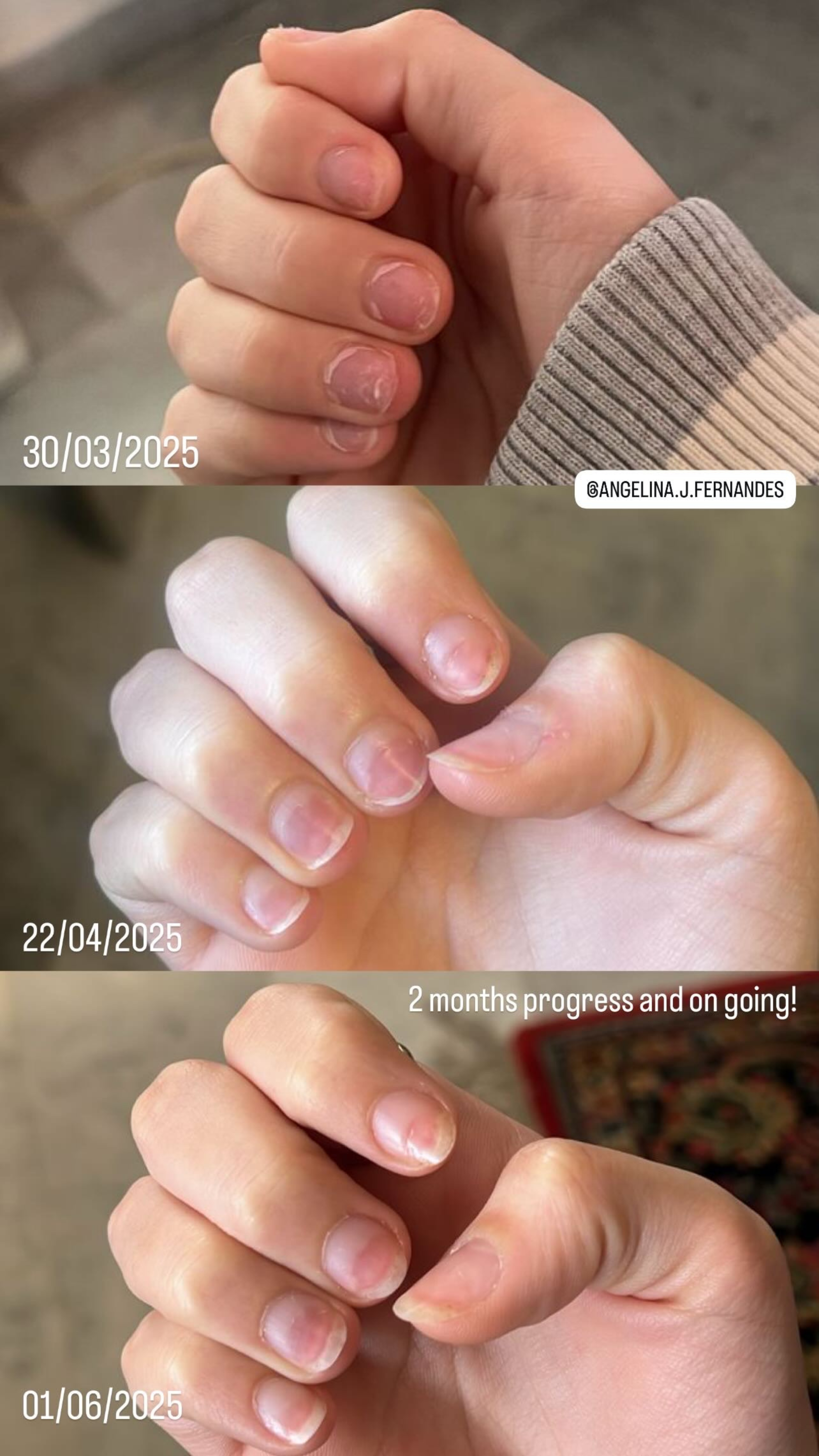 L’ANTIDOTE – Nail Regeneration Oil