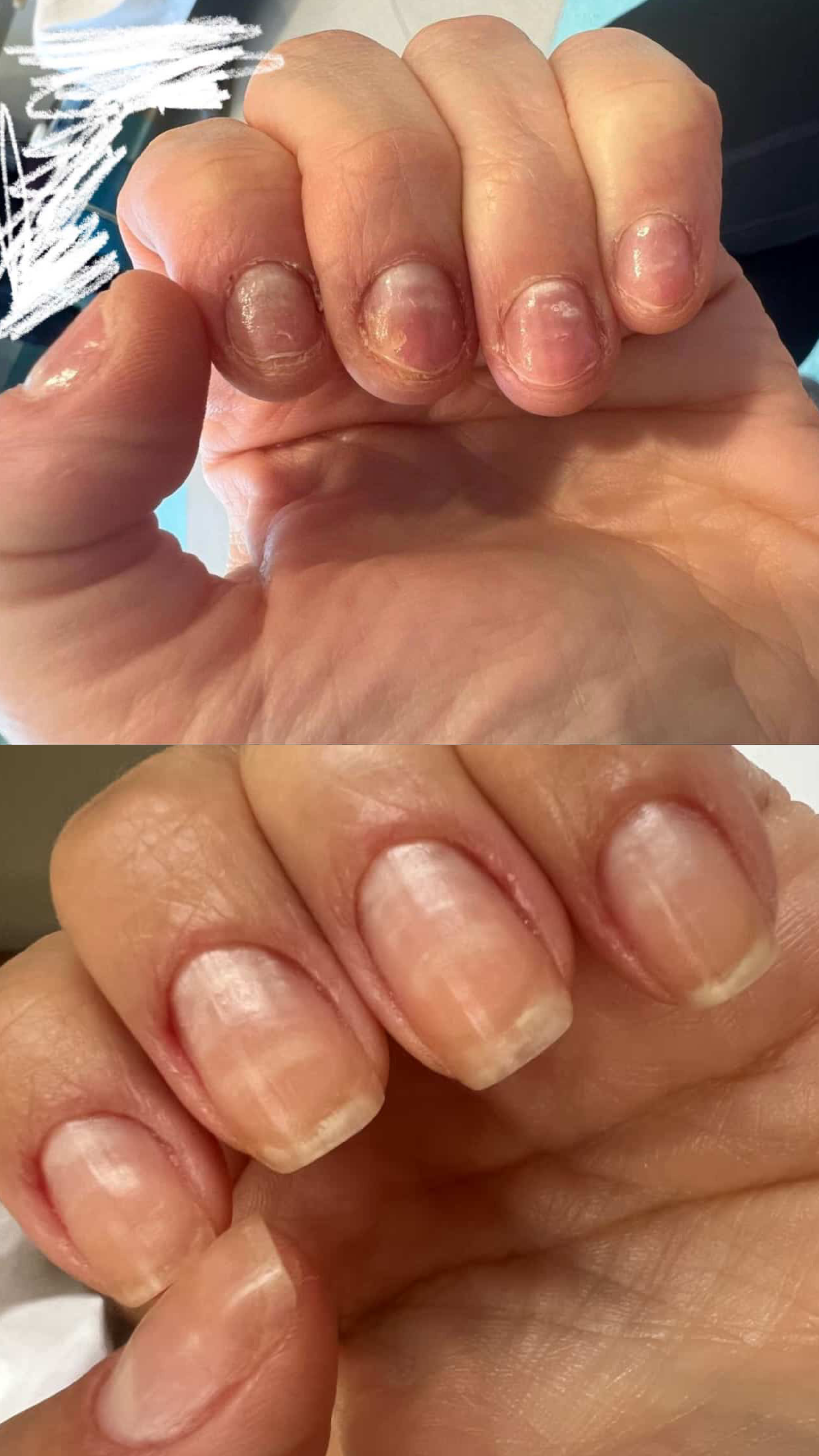 L’ANTIDOTE – Nail Regeneration Oil