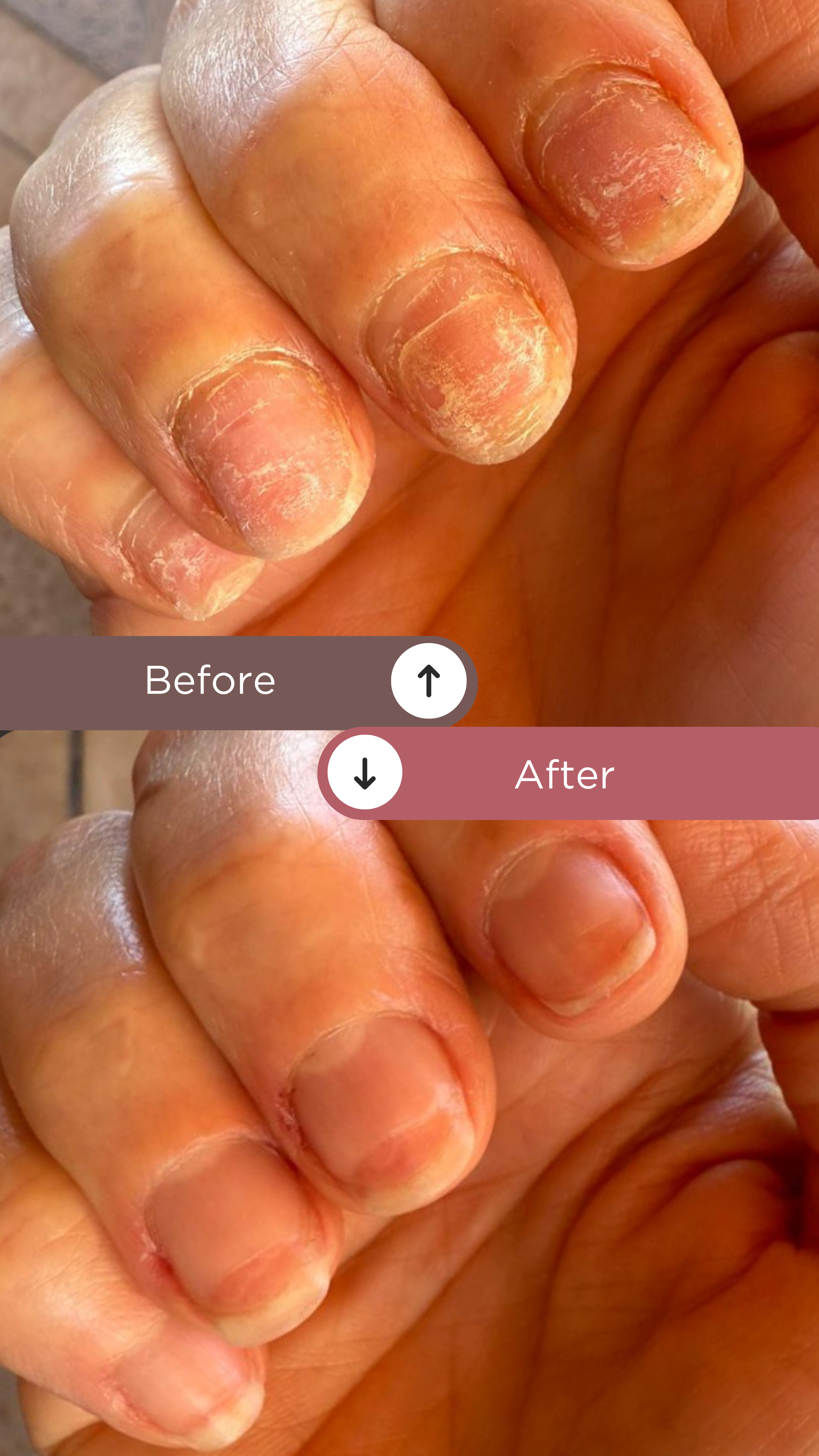 L’ANTIDOTE – Nail Regeneration Oil