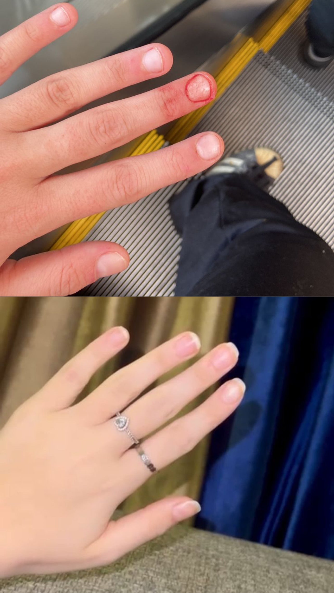 L’ANTIDOTE – Nail Regeneration Oil