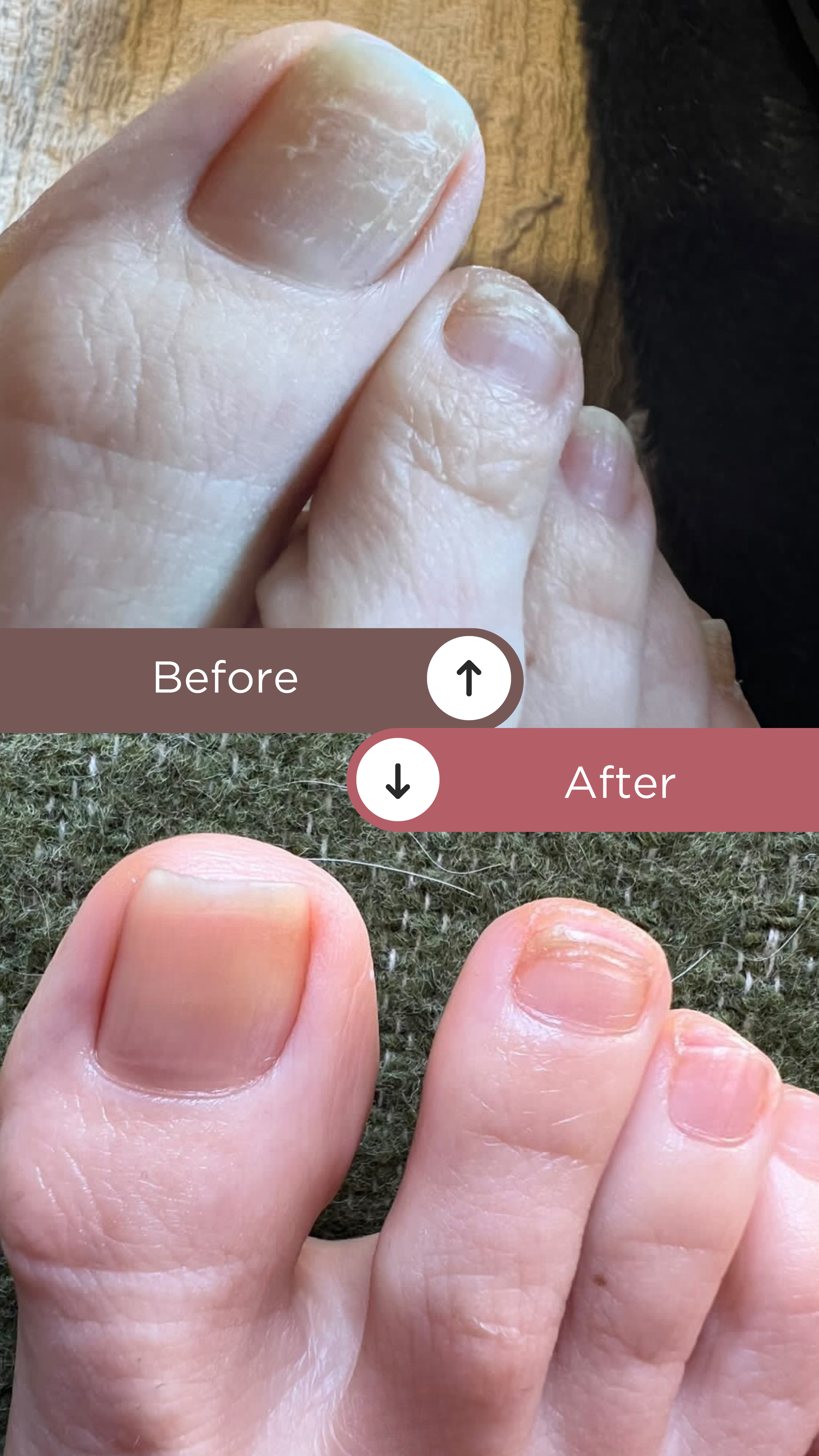 L’ANTIDOTE – Nail Regeneration Oil