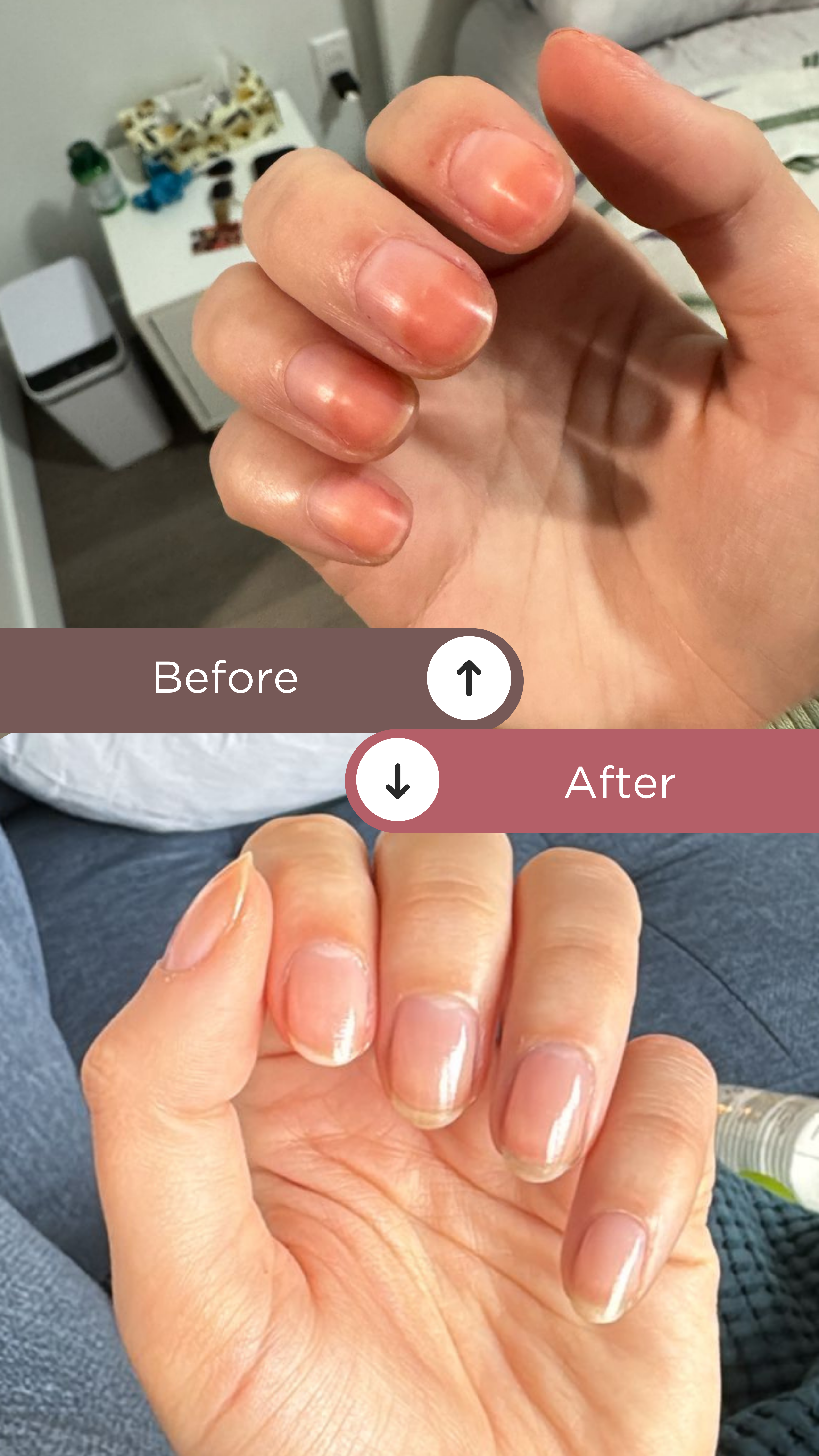 L’ANTIDOTE – Nail Regeneration Oil