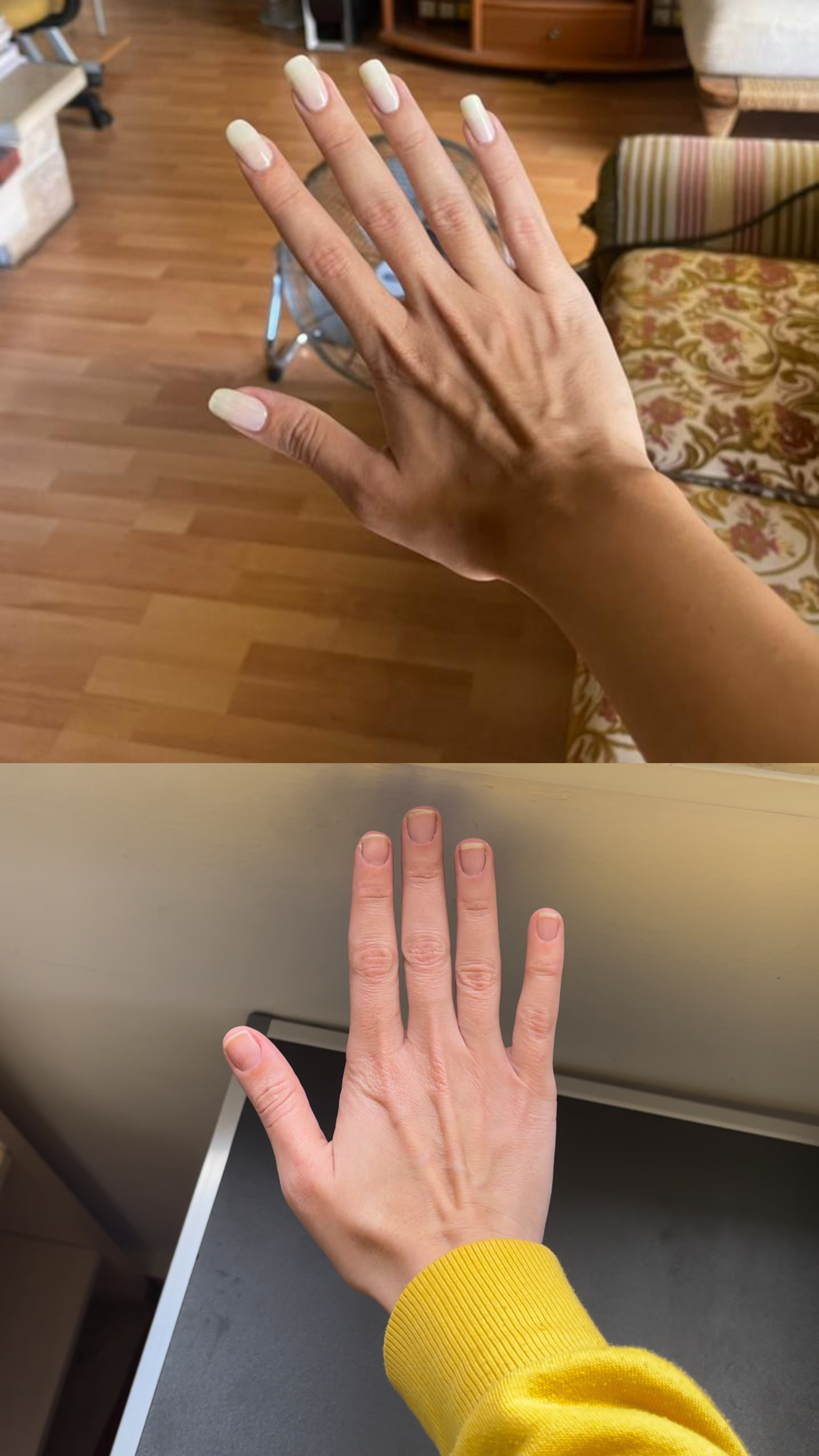 L’ANTIDOTE – Nail Regeneration Oil