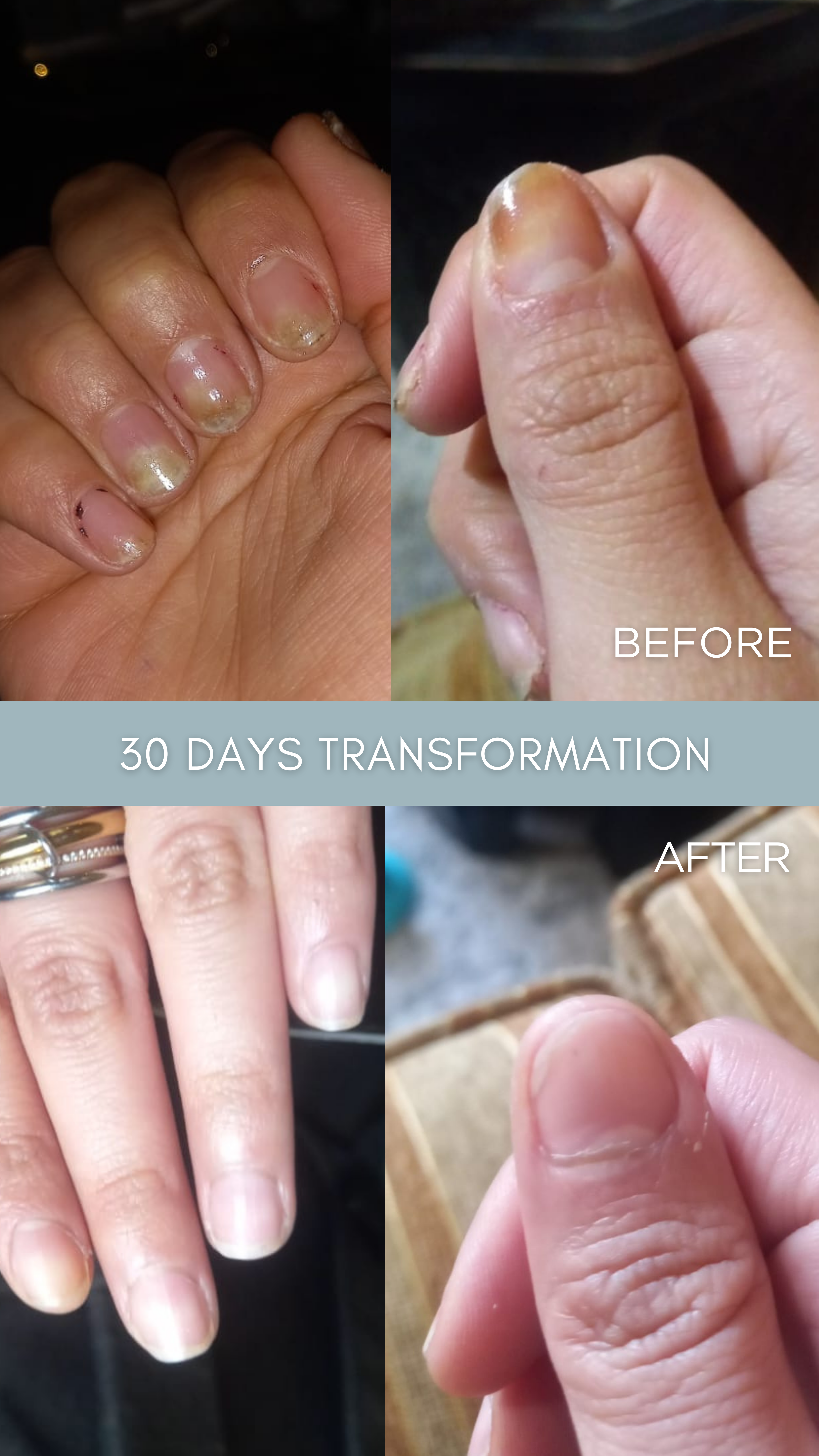 LE REMÈDE – The Antifungal Nail Restoration Oil