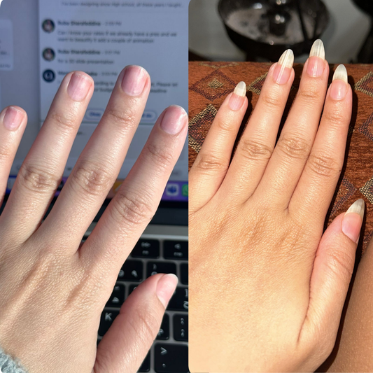 The Golden Rules: 4 Things That Are Secretly Sabotaging Your Nail Growth.