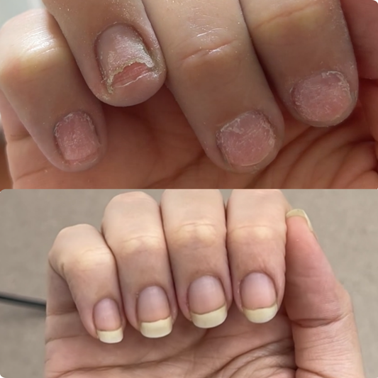 The Cycle Ends Here: How to Regenerate Your Natural Nails in 12 Weeks.