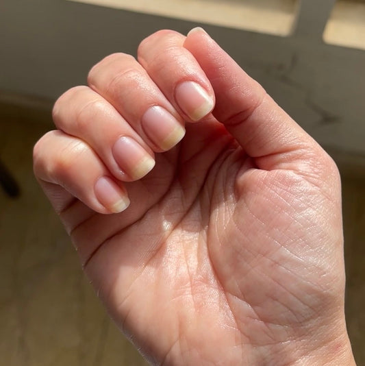 The Cycle Ends Here: How 2,000+ Women Reclaimed Their Natural Strength.