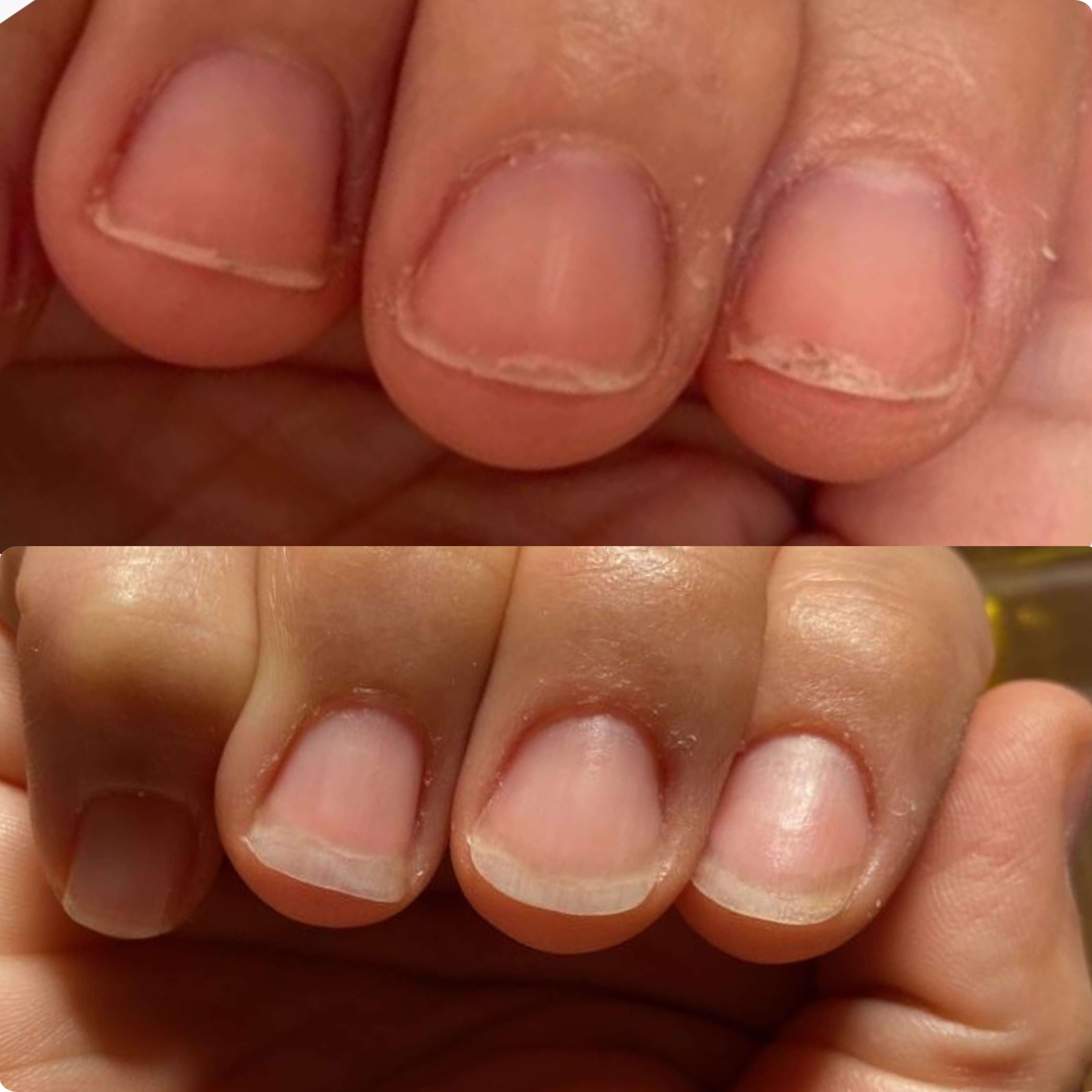 The 60-Day Nail Reset