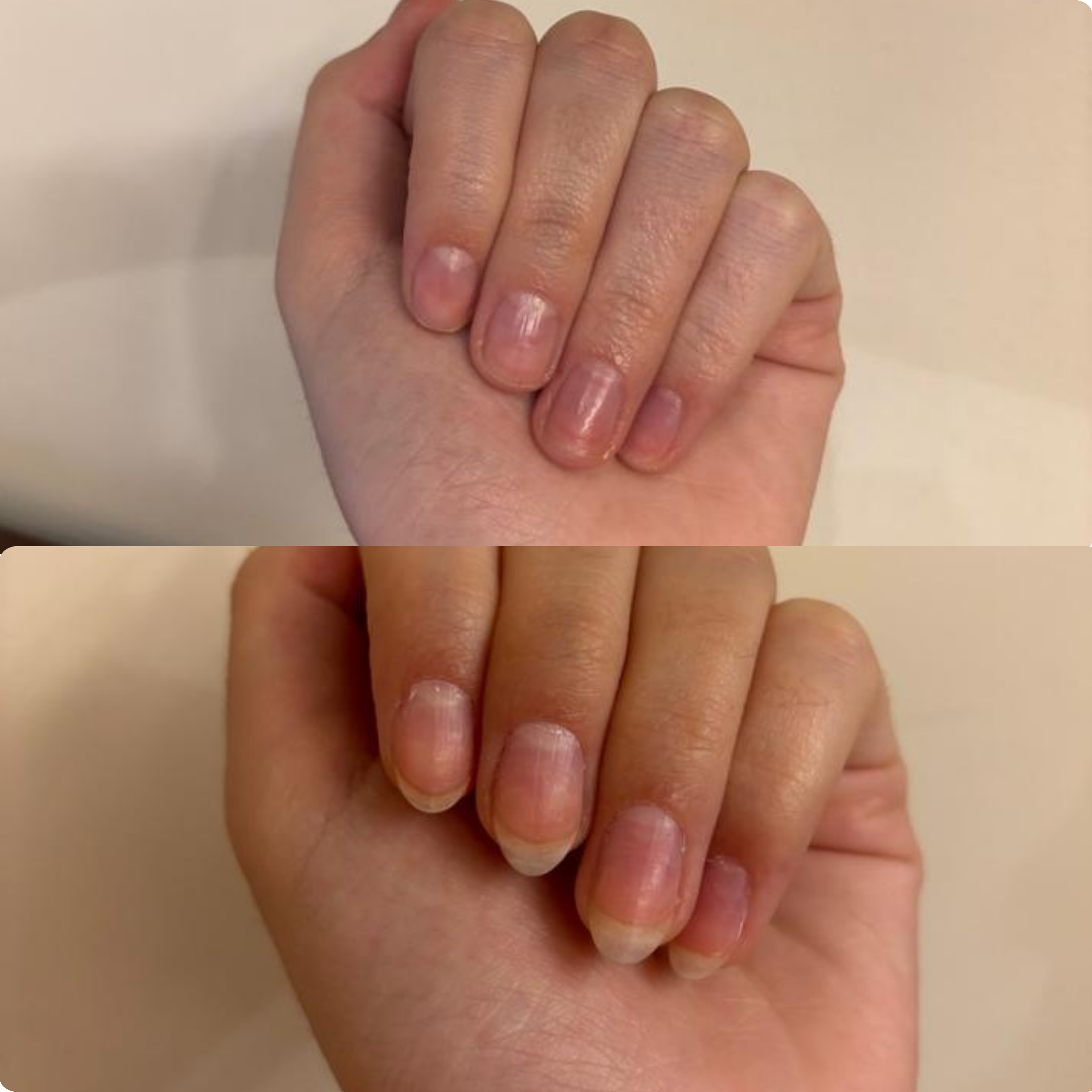 The Nail Ritual