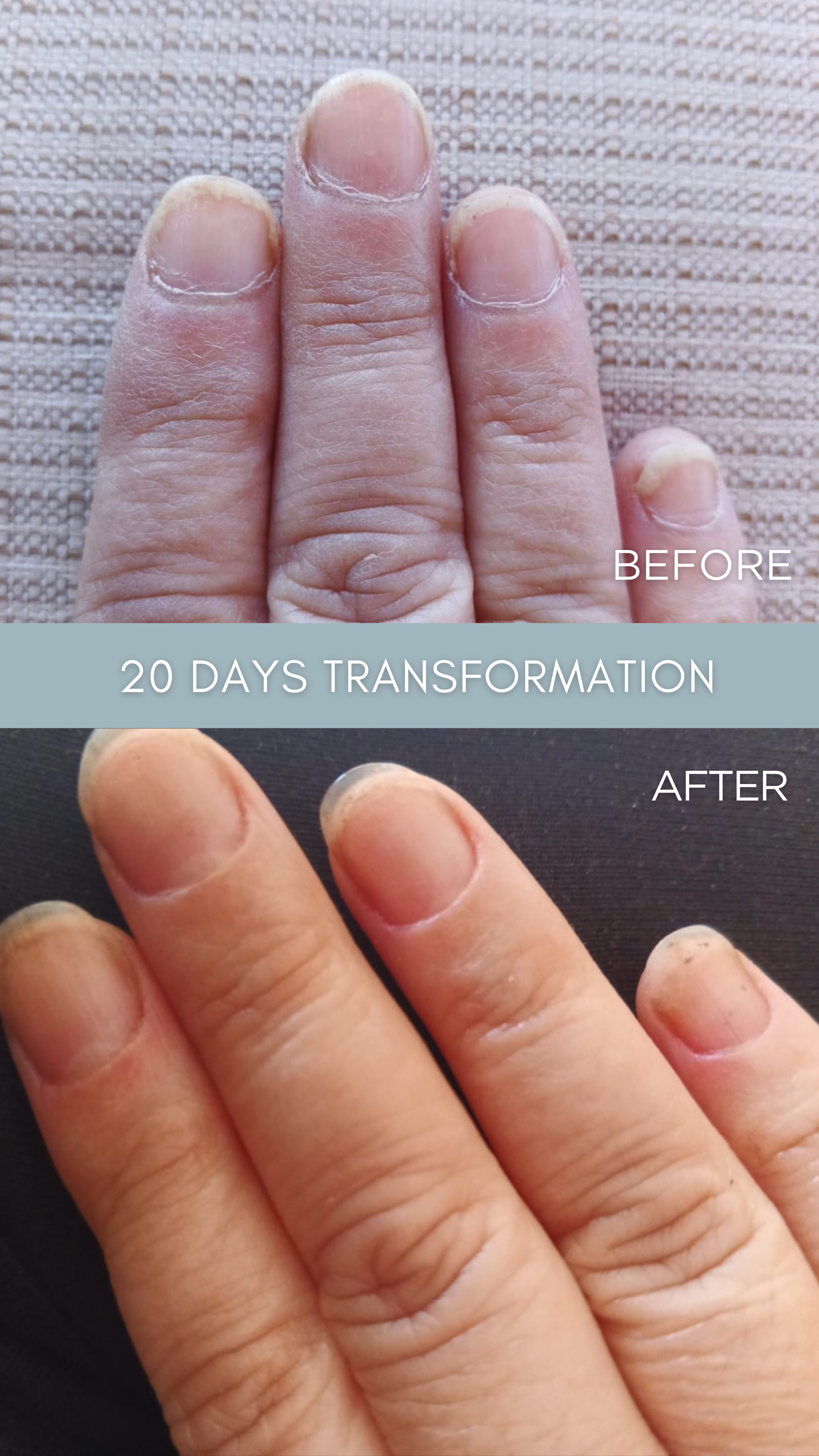 LE REMÈDE – The Antifungal Nail Restoration Oil