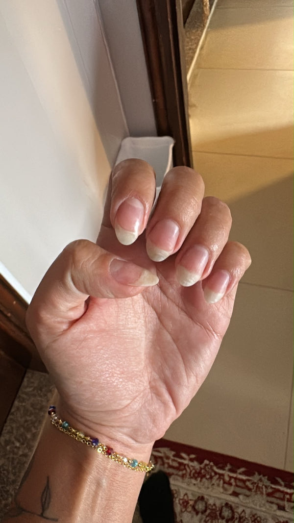 After