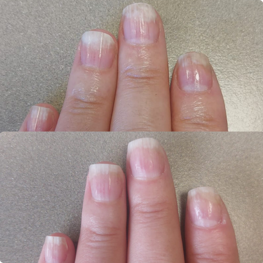 LE RÉVEIL – For Thickened, Textured, or Stubborn Nails