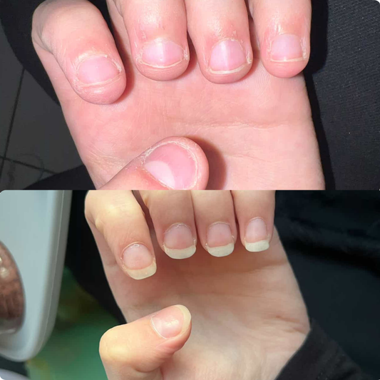 The Essential Nail Biting Ritual