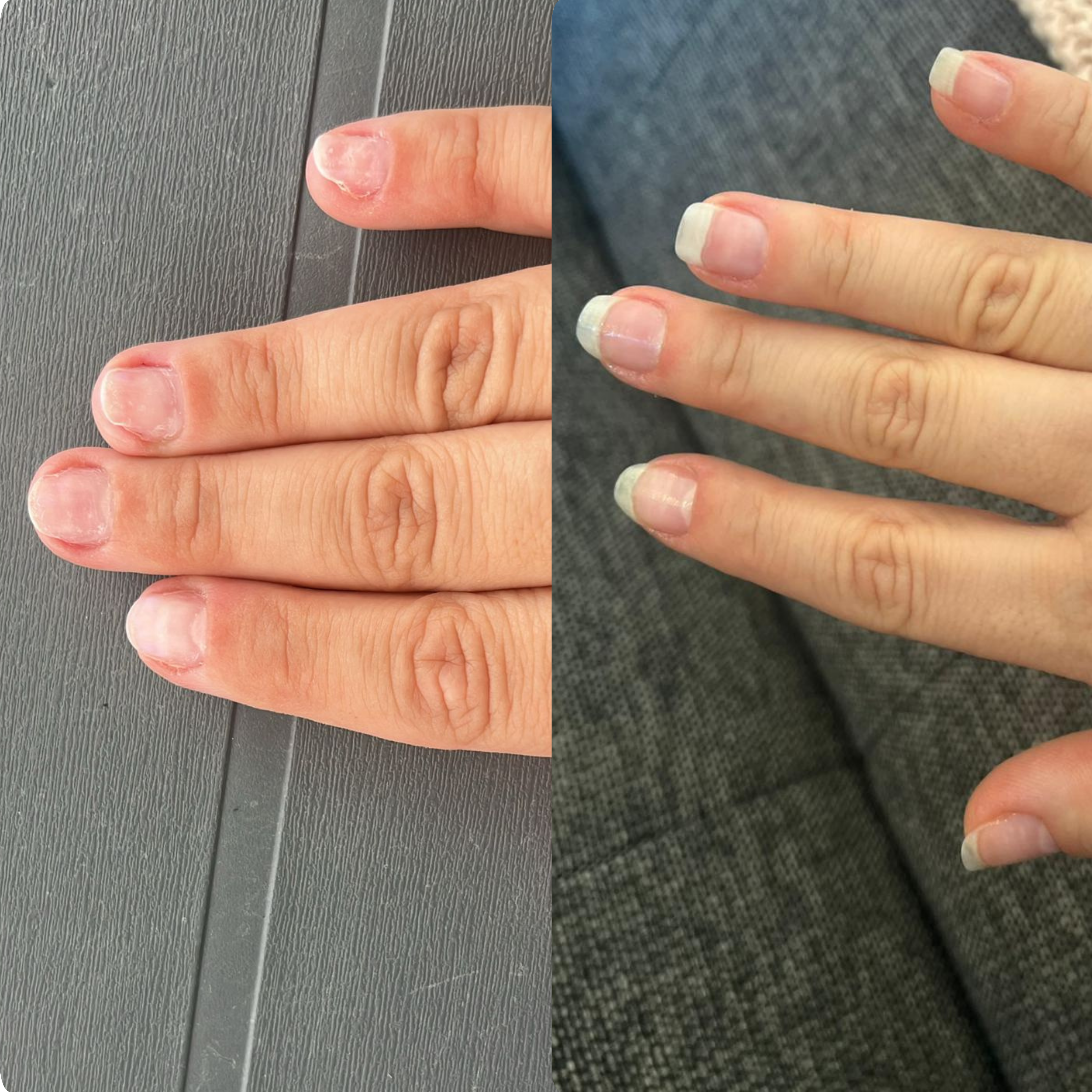 The Nail Ritual
