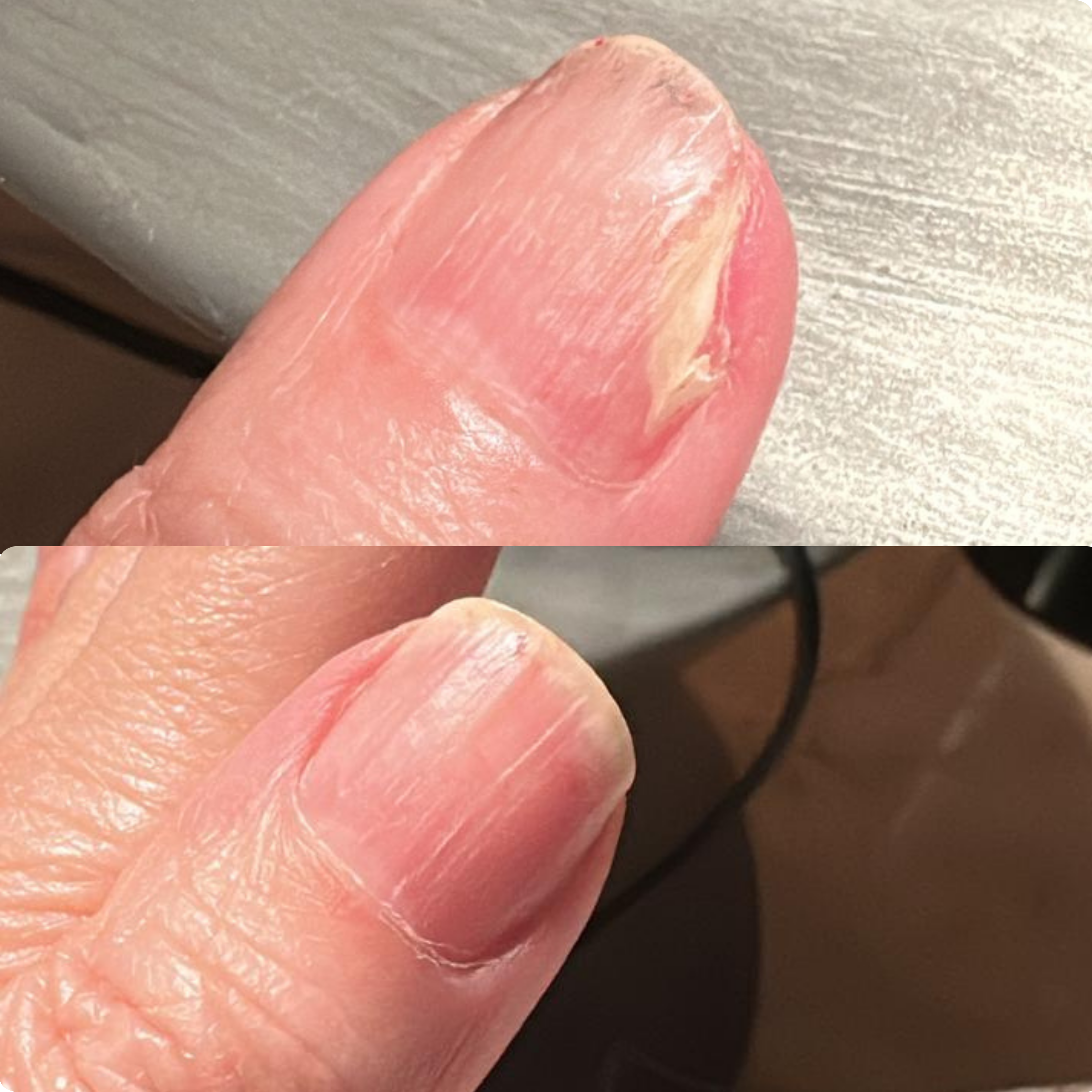 The 60-Day Nail Reset