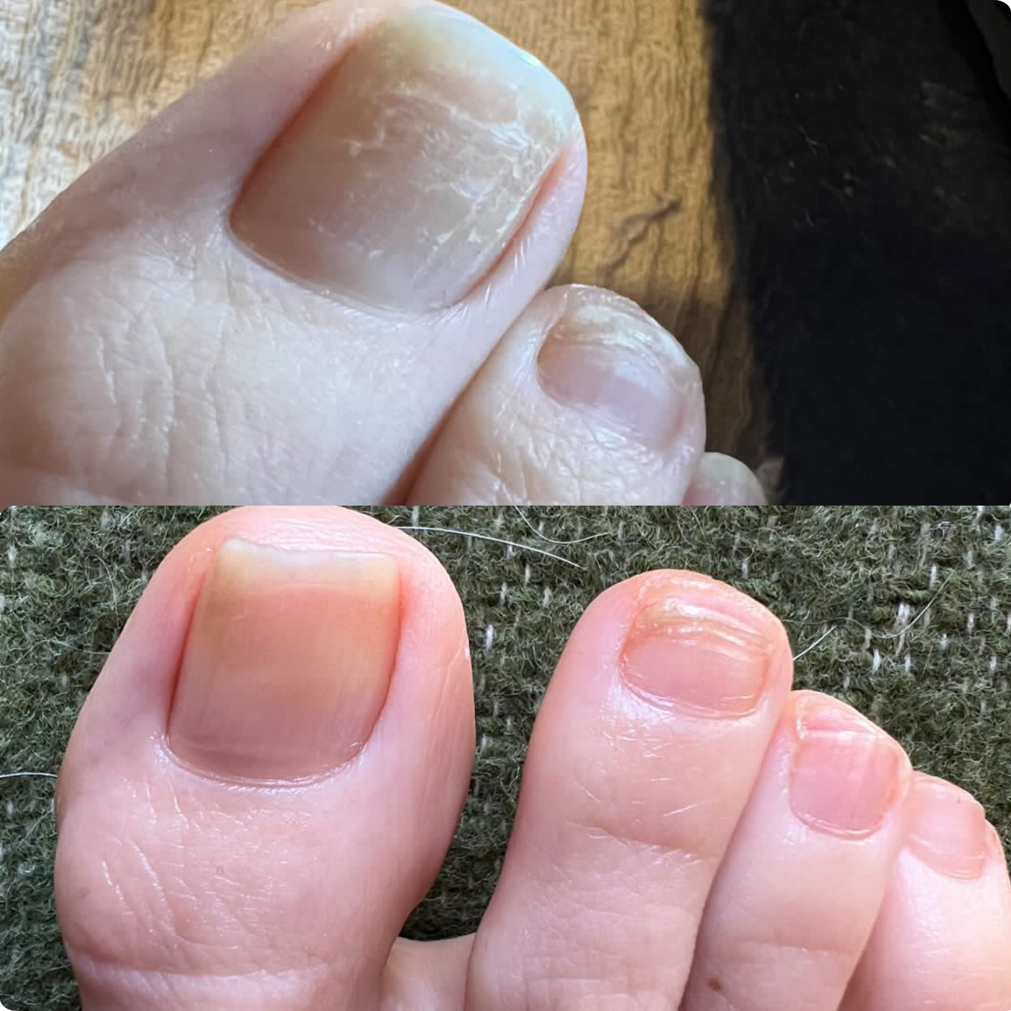 The Nail Ritual