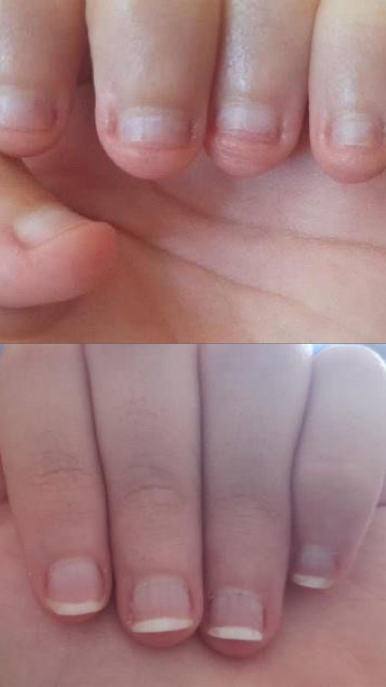 BiteBalm - Restorative Cuticle Cream for Nail Biters