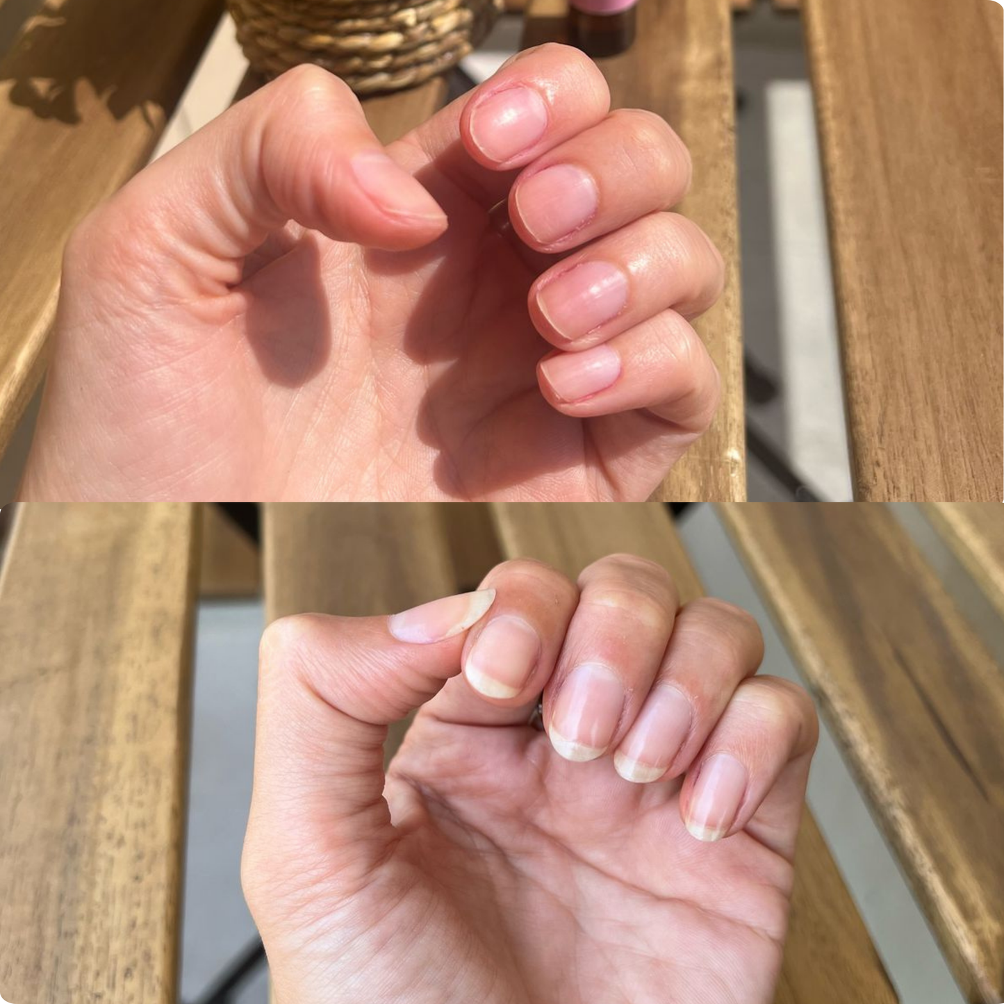 L'Antidote™ - On-The-Go Nail Recovery Pen